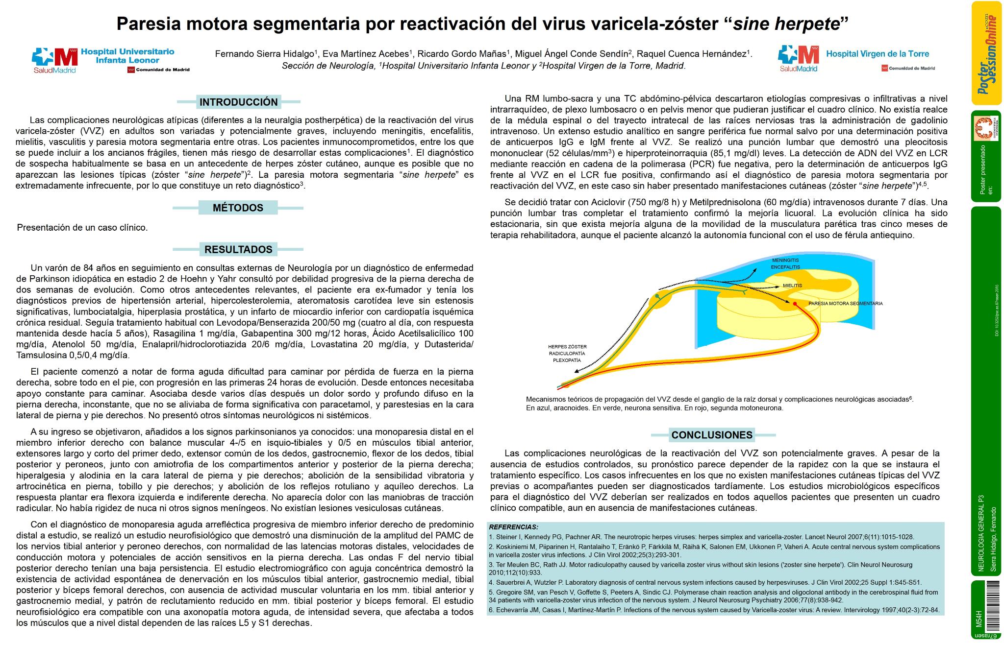 Paresia motora segmentaria por reactivación del virus varicela-zóster “sine herpete”