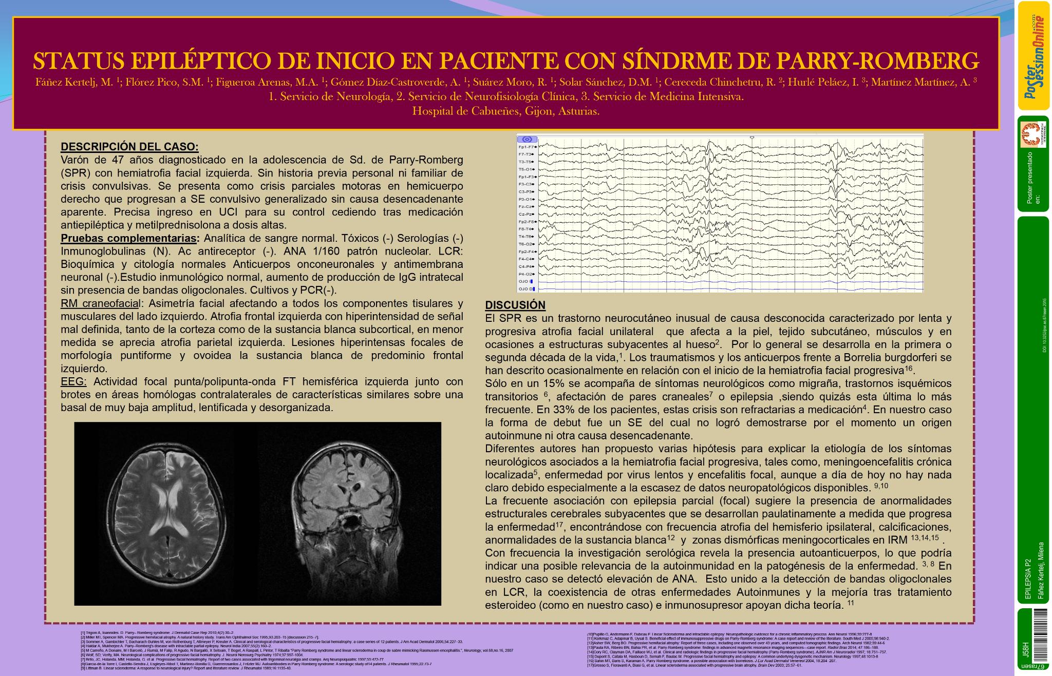 Status epiléptico de inicio en paciente con Síndrome de Parry-Romberg.