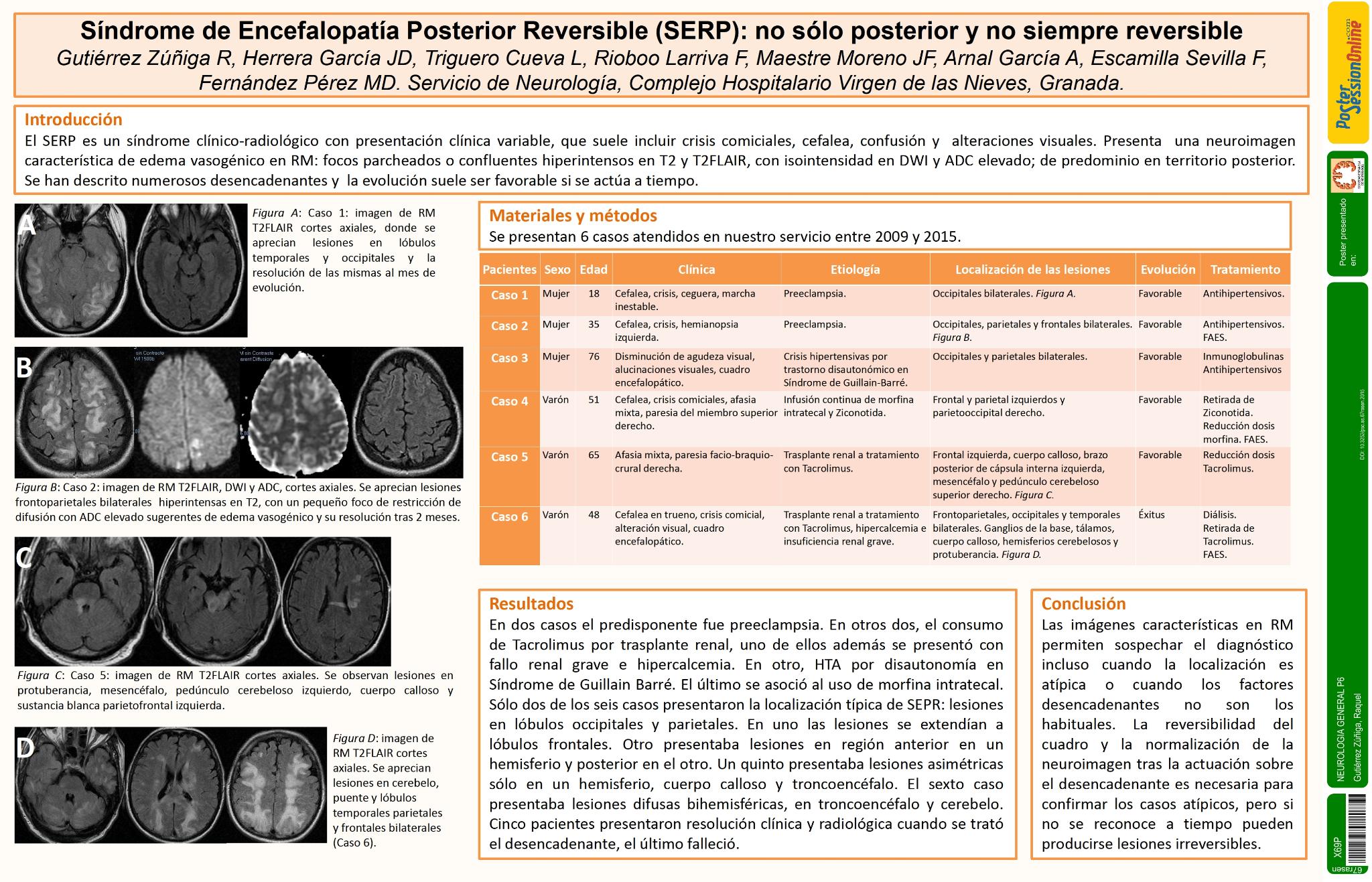 Síndrome de Encefalopatía Posterior Reversible (SERP): no sólo posterior y no siempre reversible