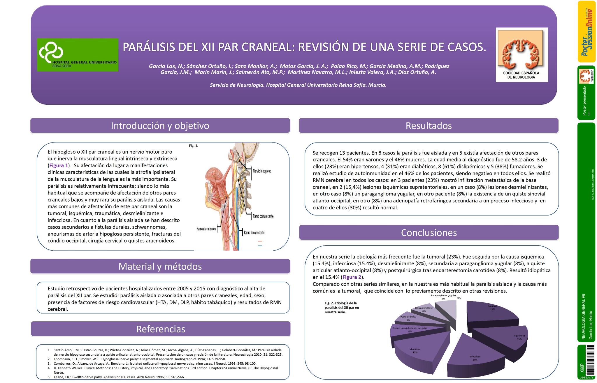 Parálisis del XII par craneal: Revisión de una serie de casos