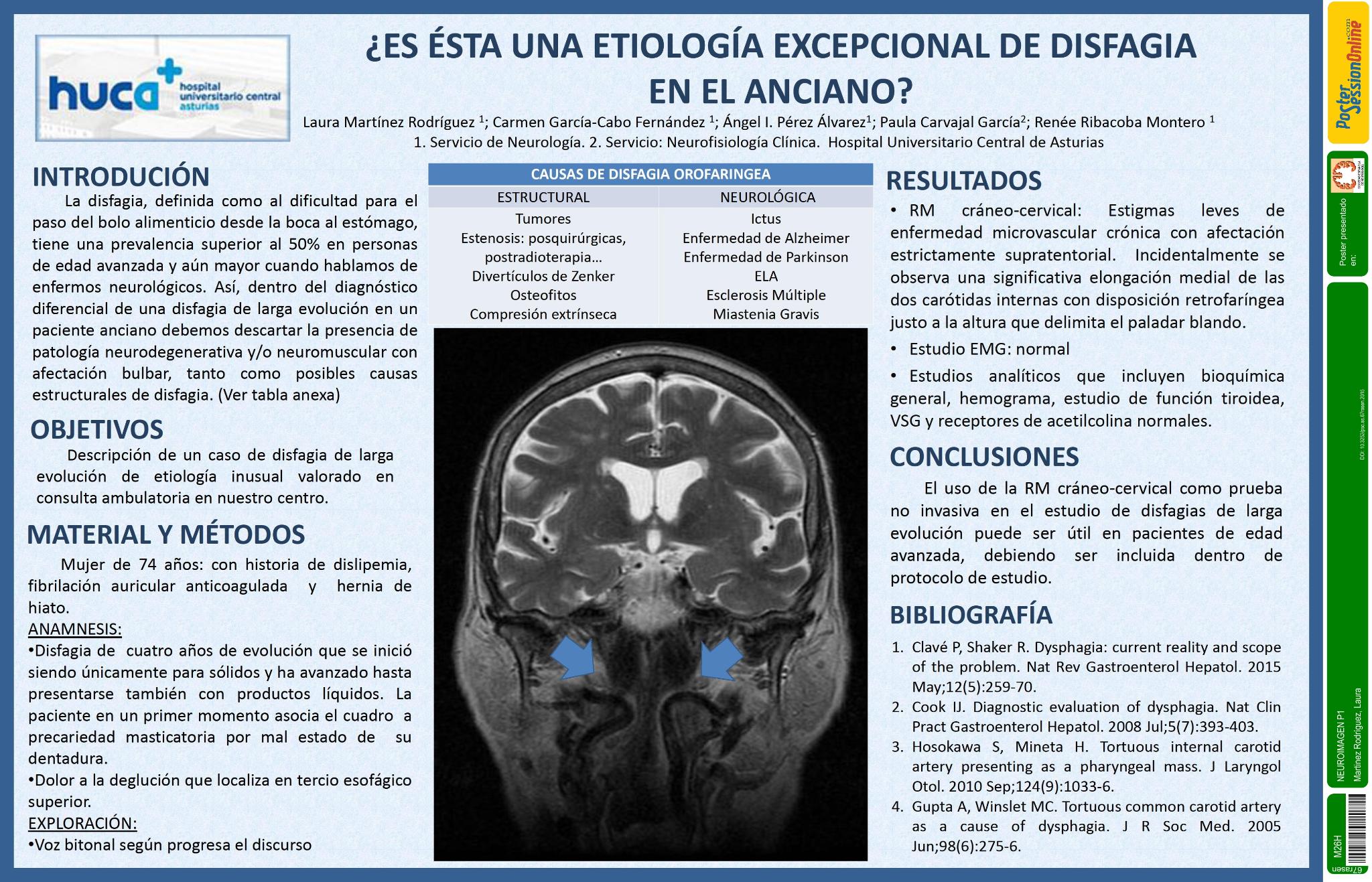 ¿Es ésta una etiología excepcional de disfagia en el anciano?