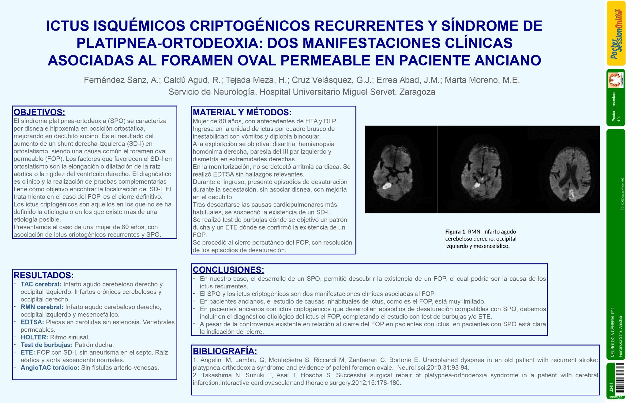 Ictus isquémicos criptogénicos recurrentes y síndrome de platipnea-ortodeoxia: dos manifestaciones clínicas asociadas al foramen oval permeable en paciente anciano