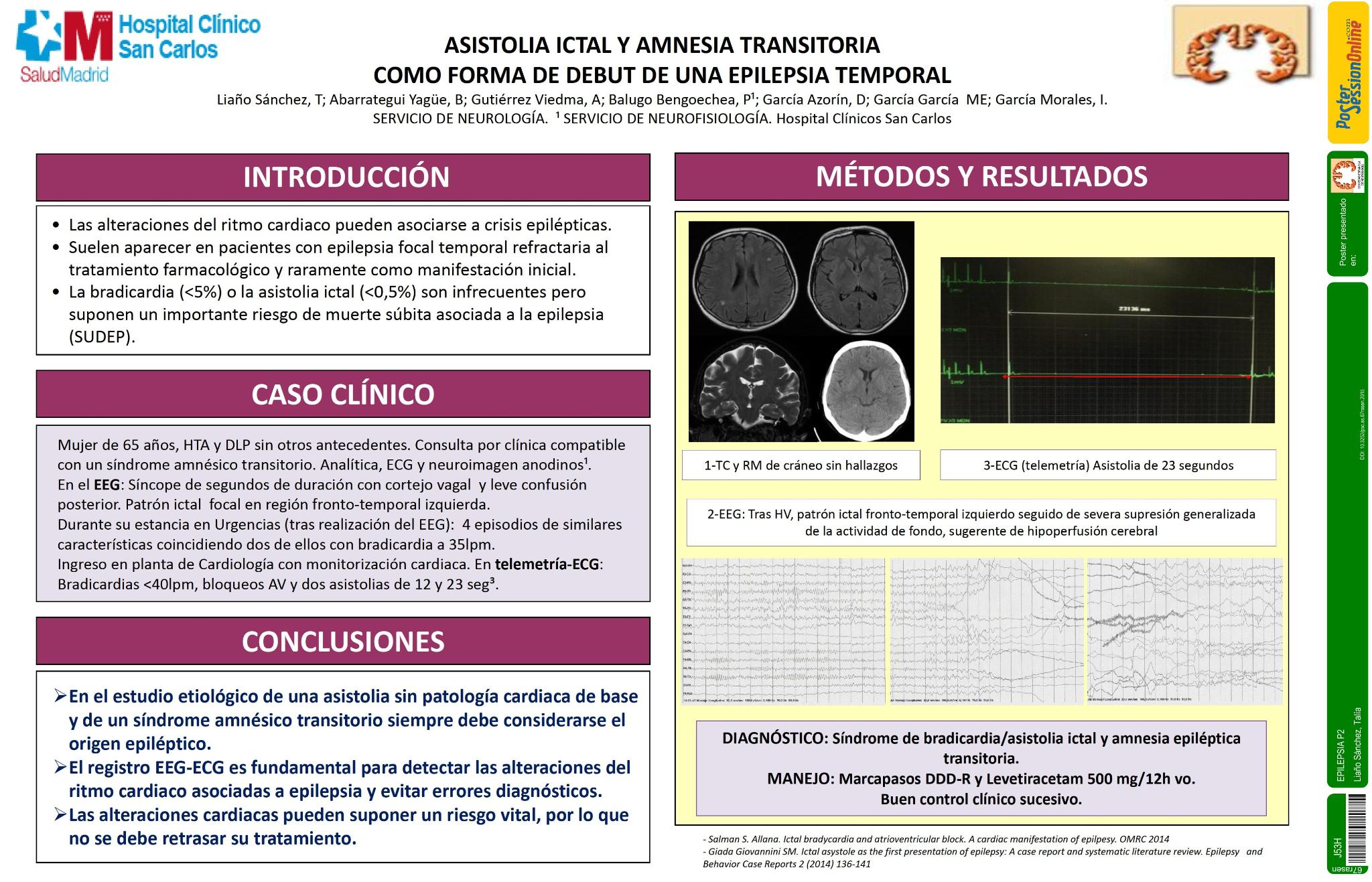 Asistolia ictal y amnesia transitoria como forma de debut de una epilepsia temporal