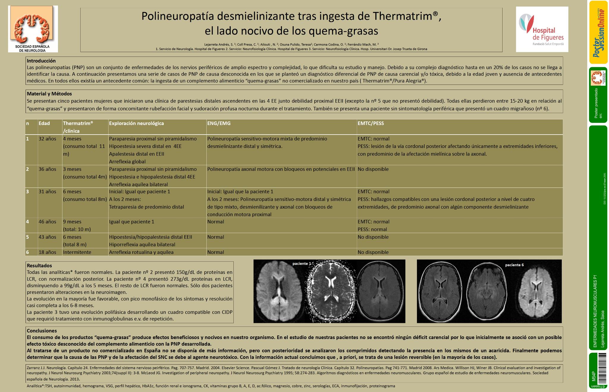 Polineuropatia desmielinizante tras ingesta de Thermatrim, el lado nocivo de los quema-grasas