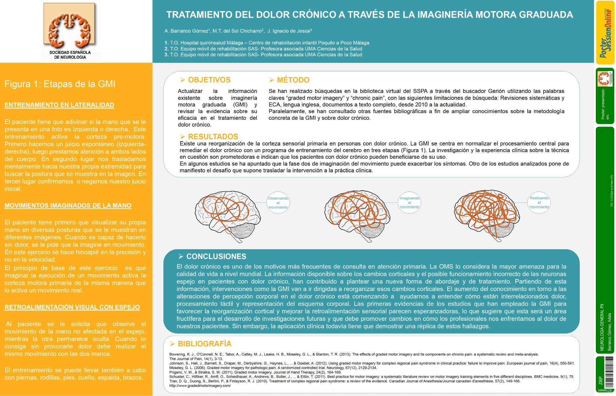 Tratamiento del dolor crónico a través de la imaginería motora graduada