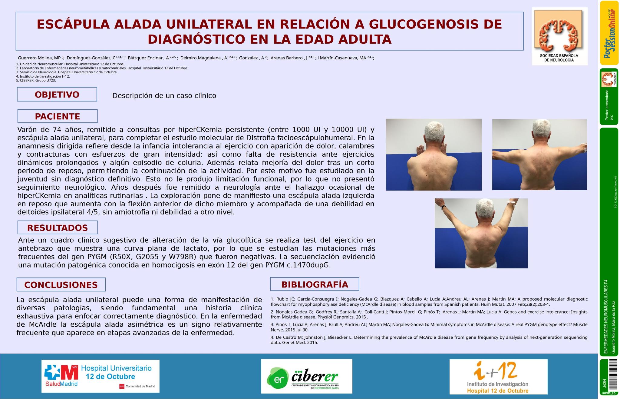Escápula alada unilateral en relación a glucogenosis de diagnóstico en la edad adulta