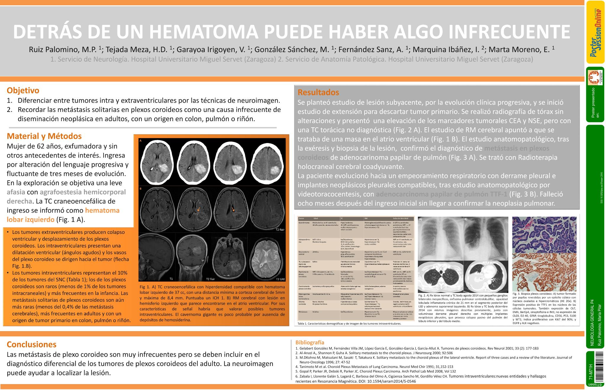 Detrás de un hematoma puede haber algo infrecuente