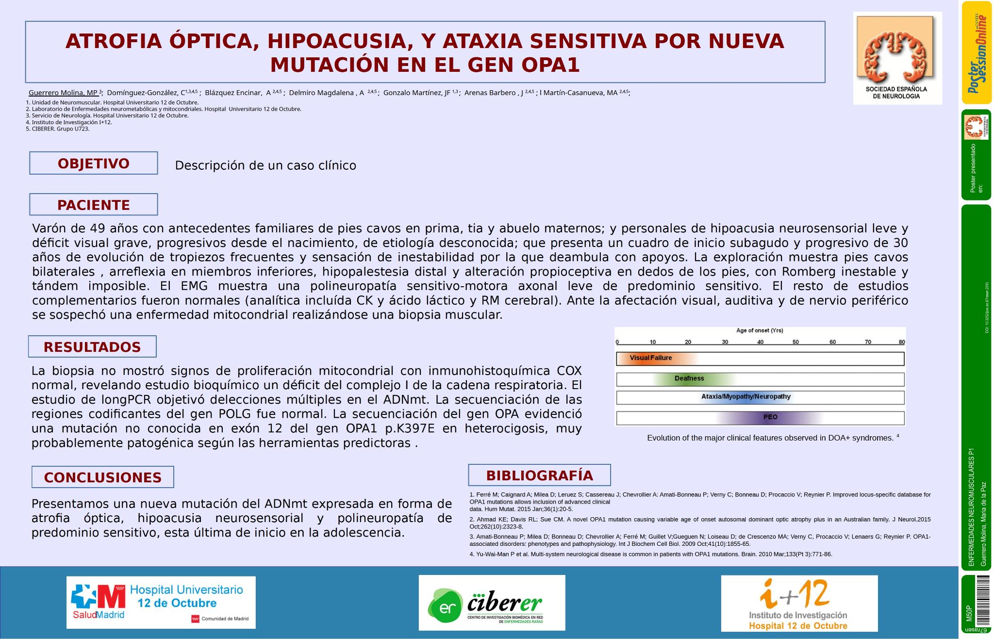 Atrofia óptica, hipoacusia, y ataxia sensitiva por mutación en OPA1 no conocida.