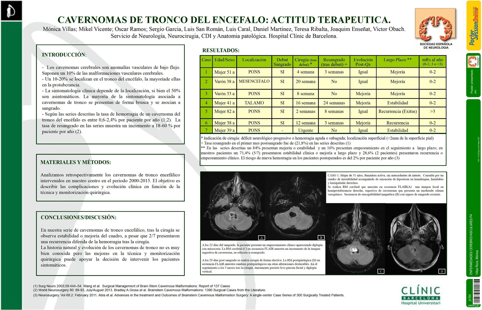 Cavernomas de tronco del encefalo: actitud terapeutica