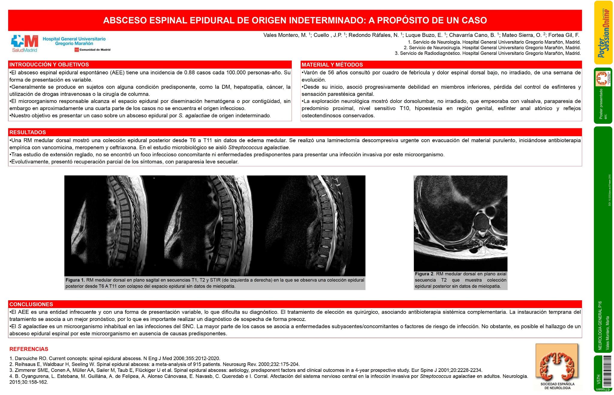 Absceso espinal epidural de origen indeterminado: a propósito de un caso