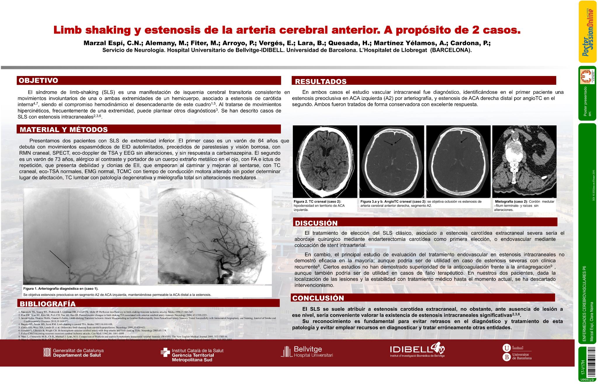 Limb shaking y estenosis de la arteria cerebral anterior. A propósito de 2 casos