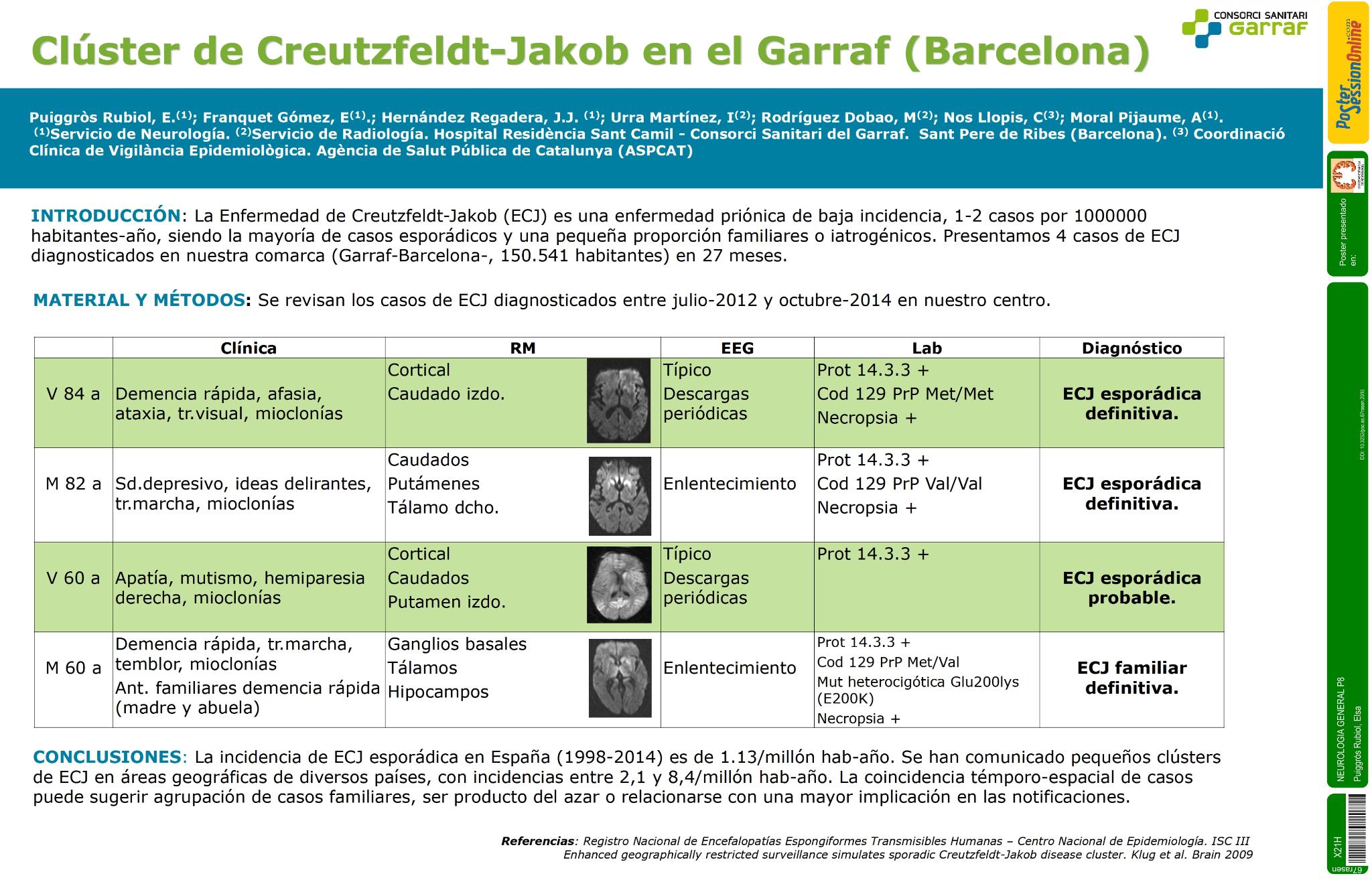 Clúster de Creutzfeldt-Jakob en El Garraf (Barcelona)