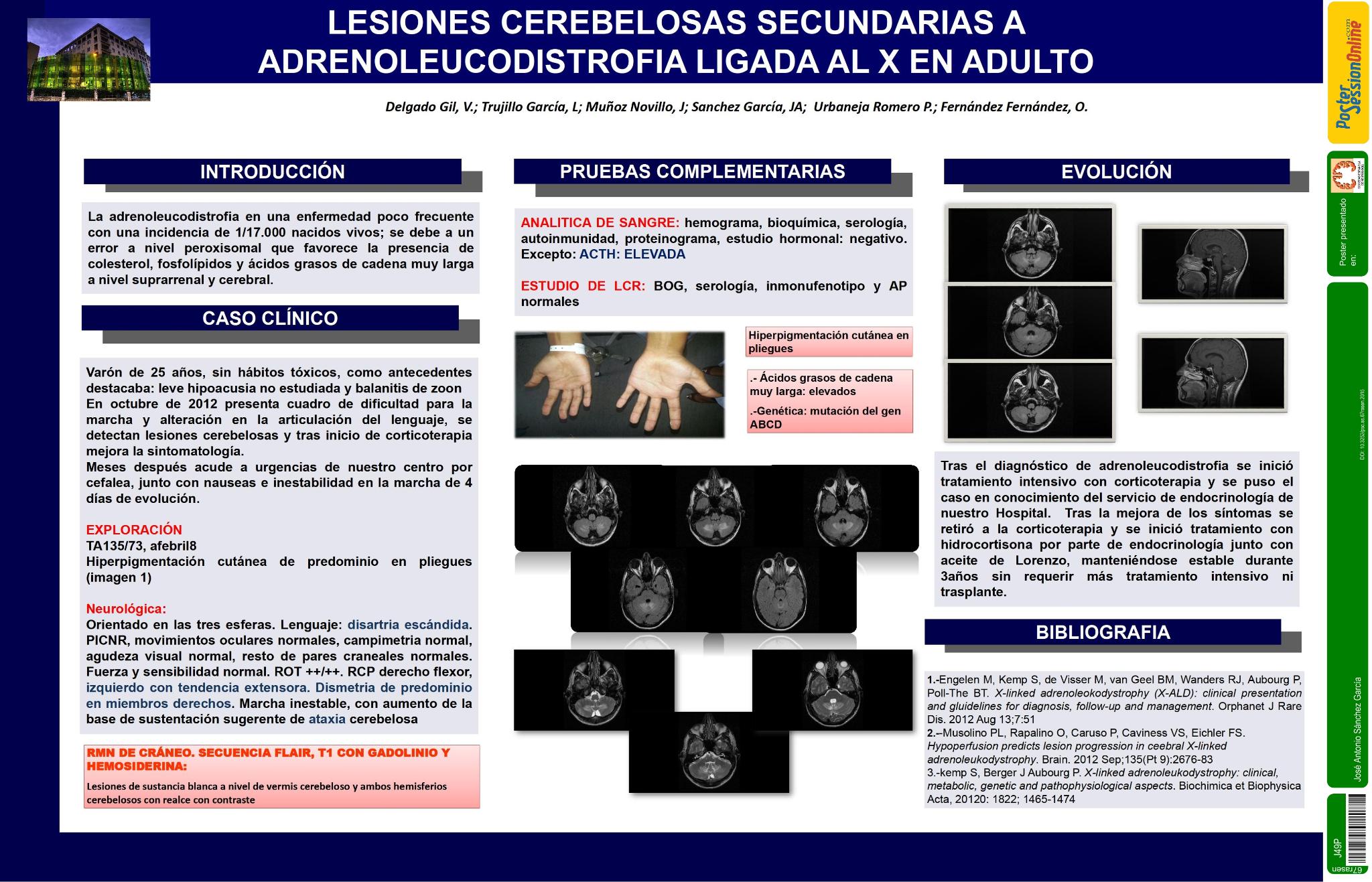 Lesiones cerebelosas secundarias a Adrenoleucodistrofia ligada al X en adulto