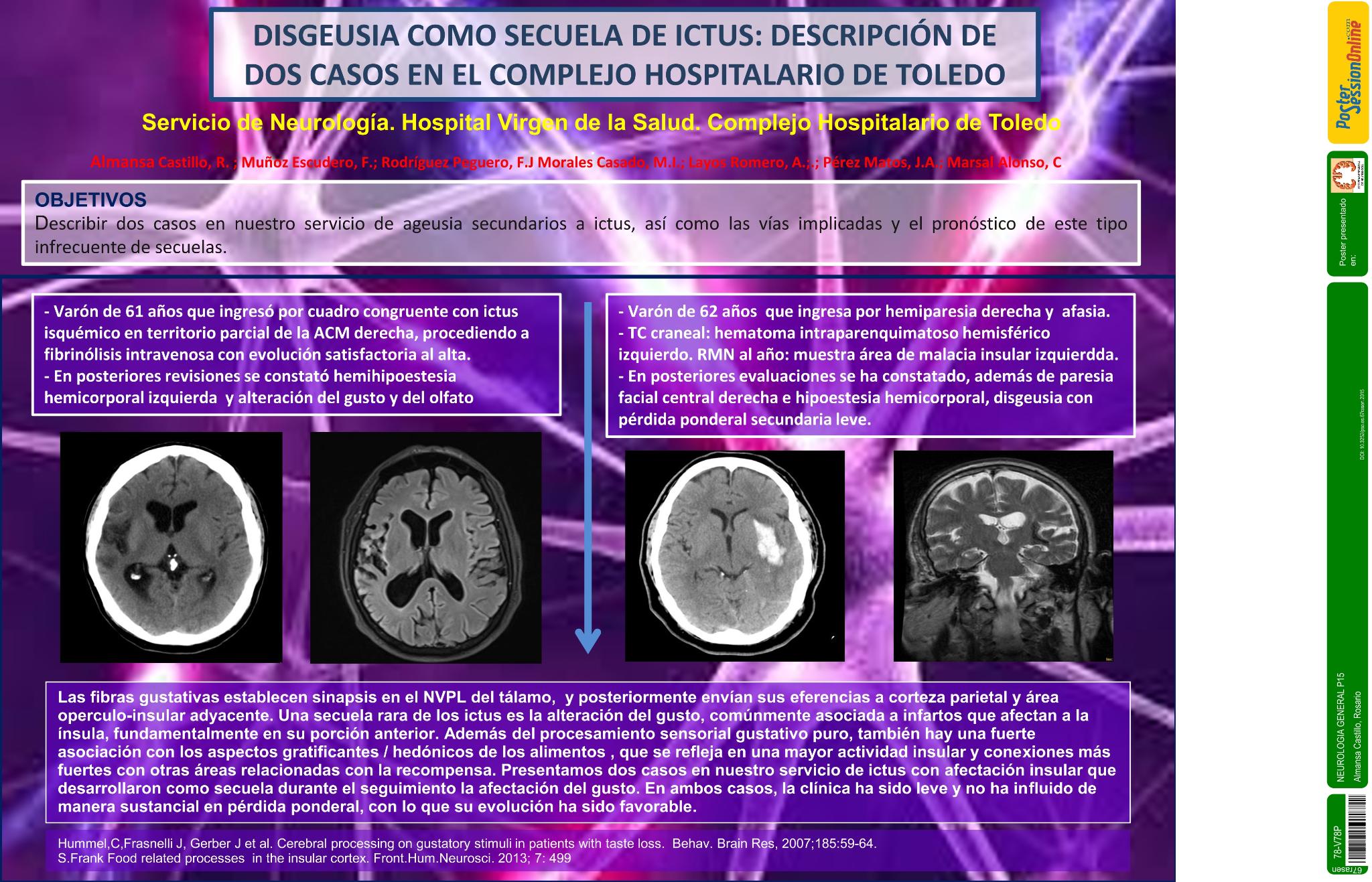 Disgeusia como secuela de ictus: descripción de dos casos en el Complejo Hospitalario de Toledo