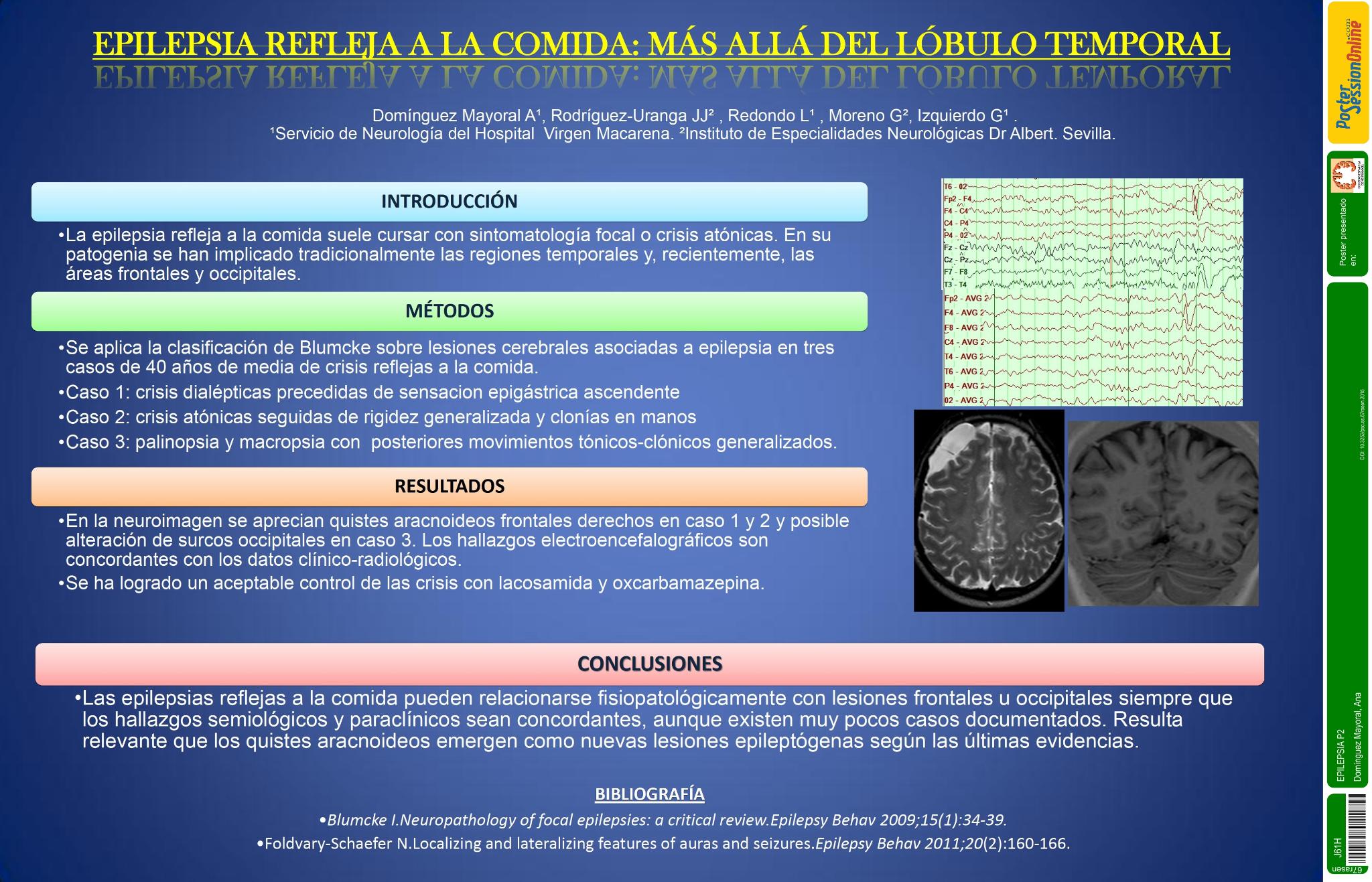 Epilepsia refleja a la comida: más allá del lóbulo temporal