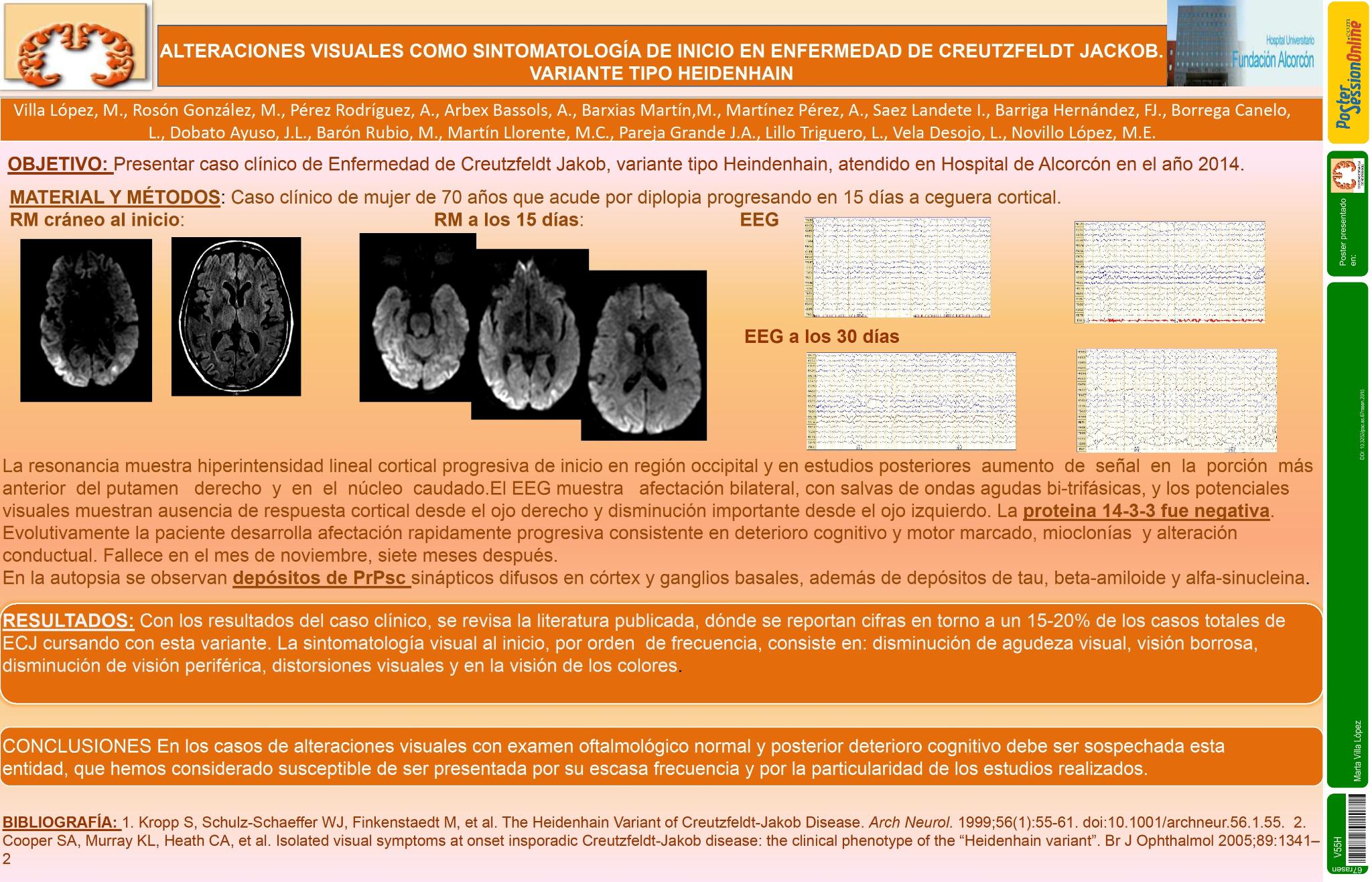 Alteraciones visuales como sintomatología de inicio de enfermedad de Creutzfeldt Jakob. Variante tipo Heidenhain