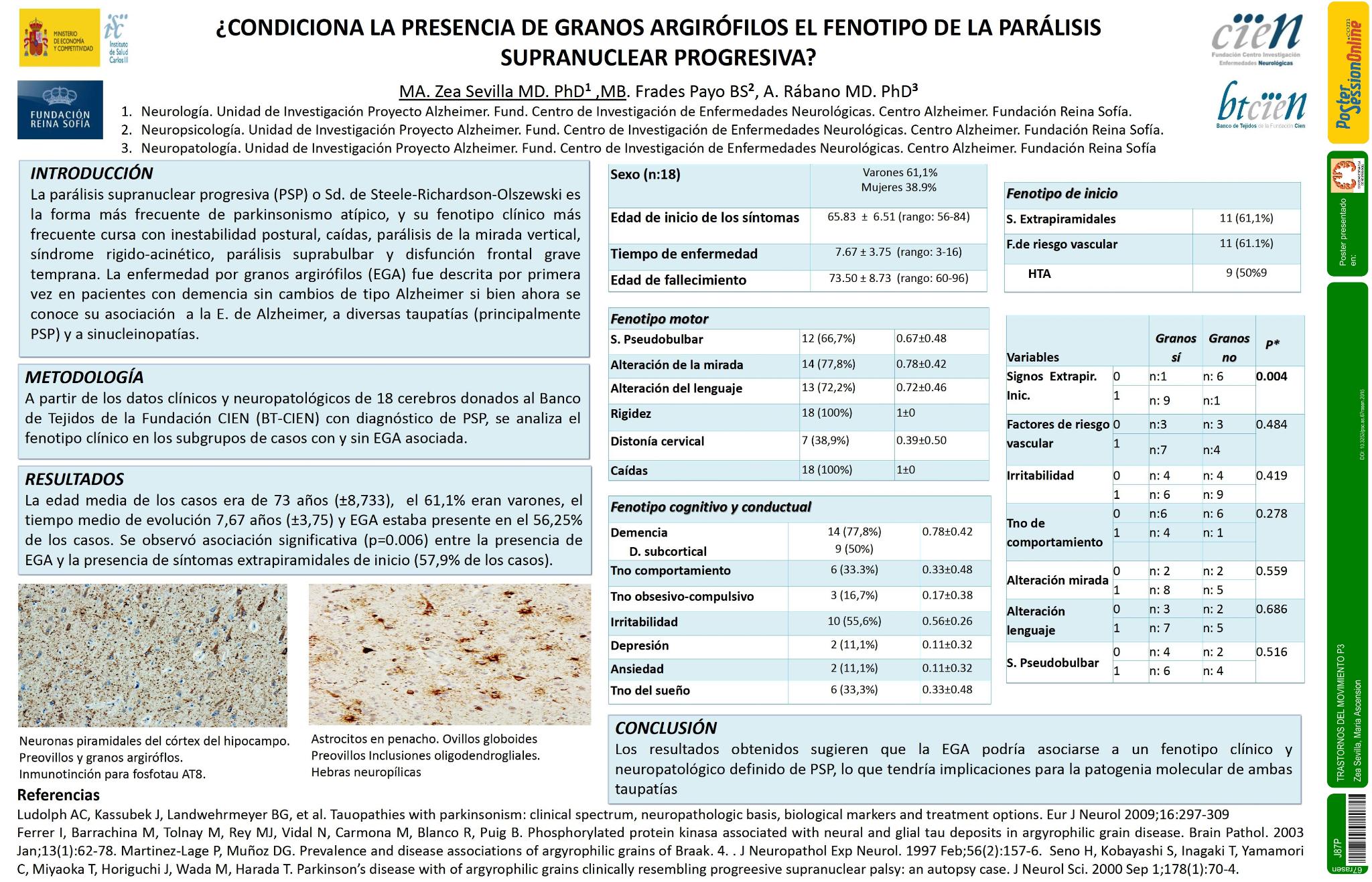 ¿Condiciona la presencia de granos argirófilos el fenotipo de la parálisis supranuclear progresiva?