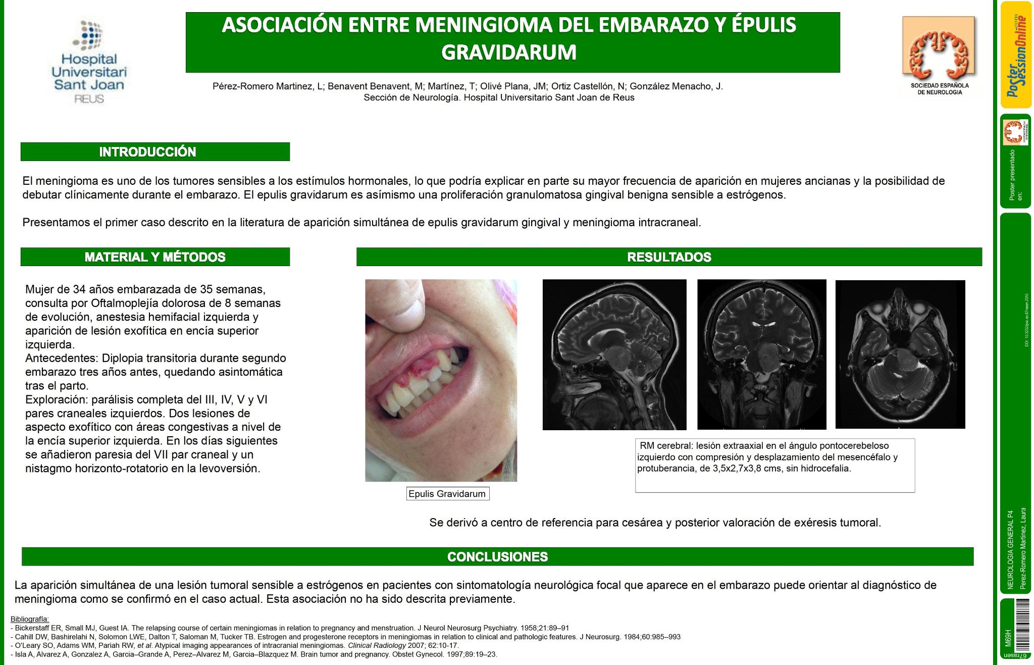 Asociacion entre meningioma del embarazo y epulis gravidarum: primer caso descrito en la literatura