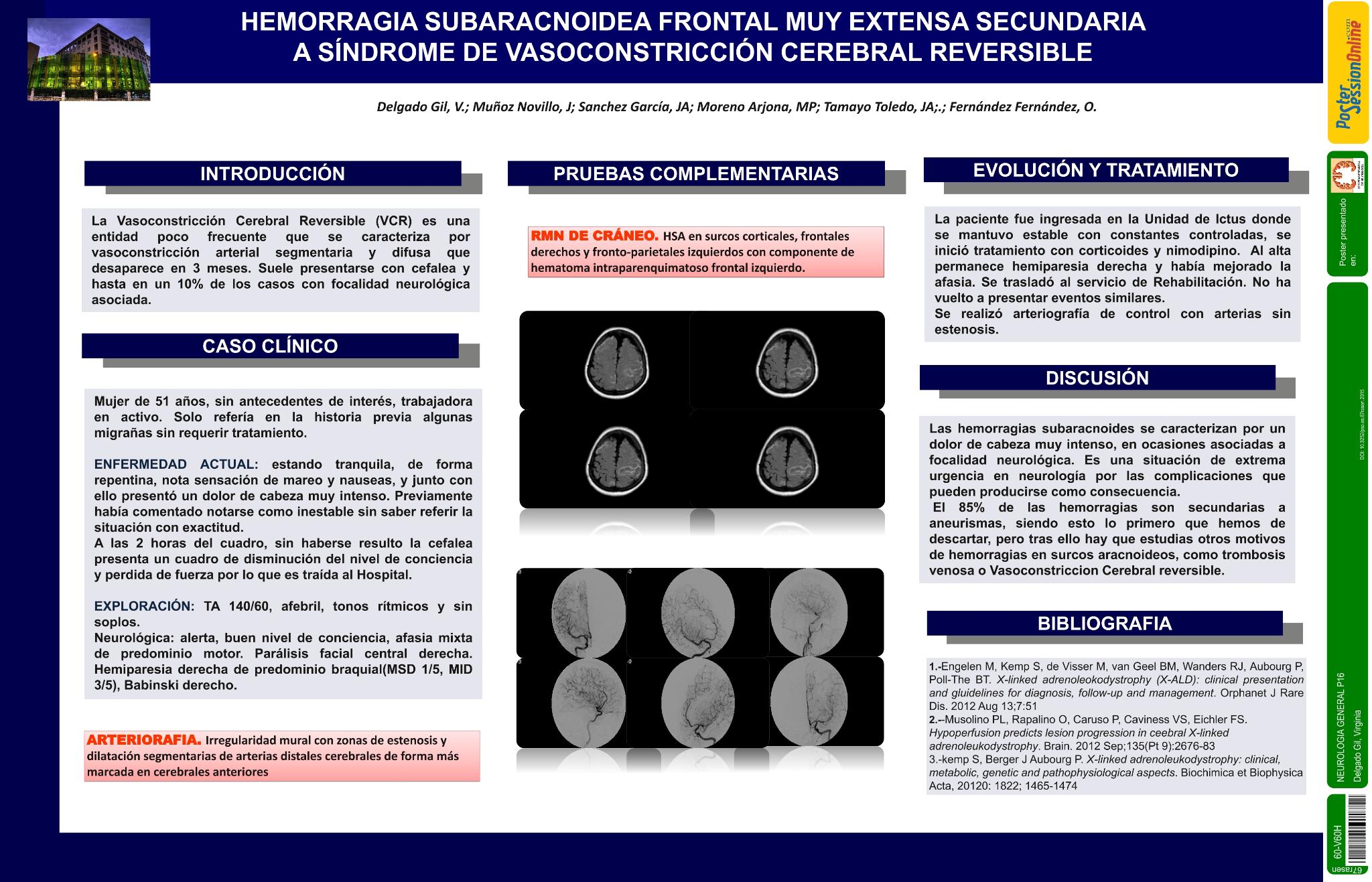Hemorragia subaracnoidea frontal muy extensa secundaria a síndrome de vasoconstricción cerebral reversible