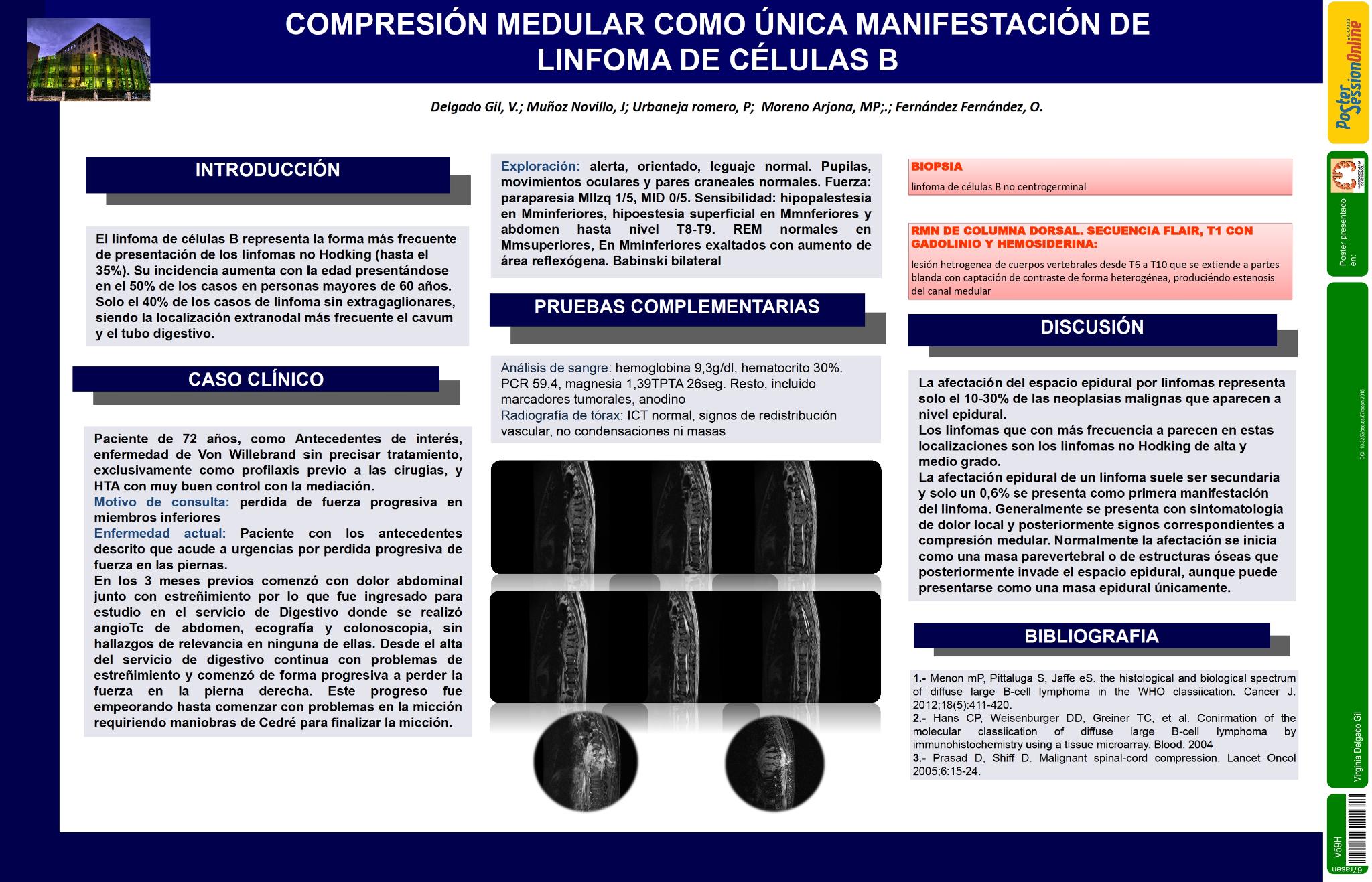 Compresión medular como única manifestación de linfoma de células B