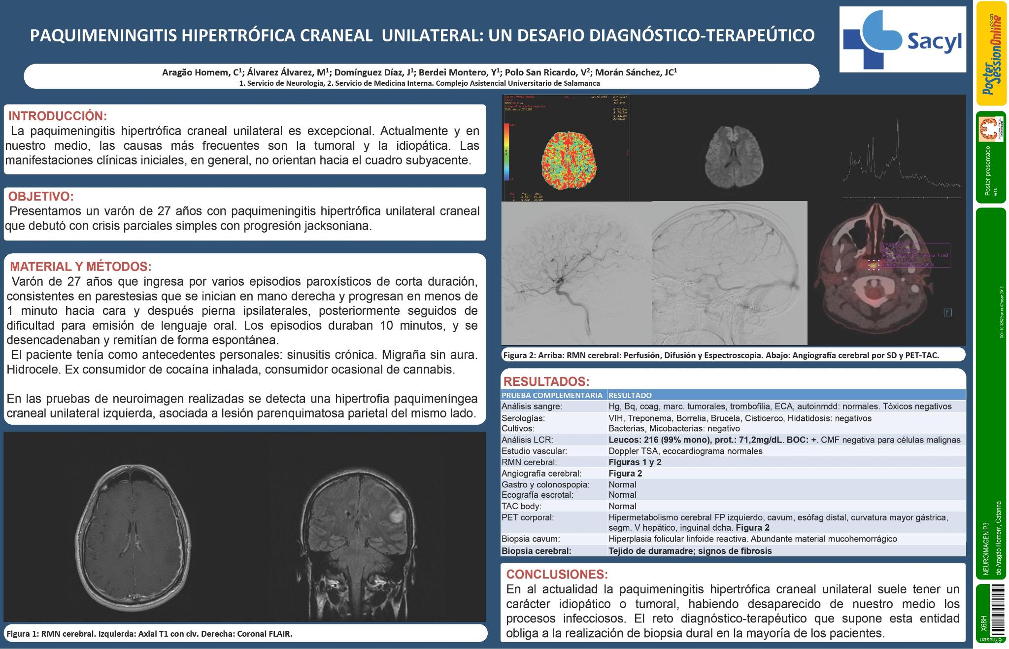 Paquimeningitis hipertrófica craneal unilateral: un desafio diagnóstico-terapeútico