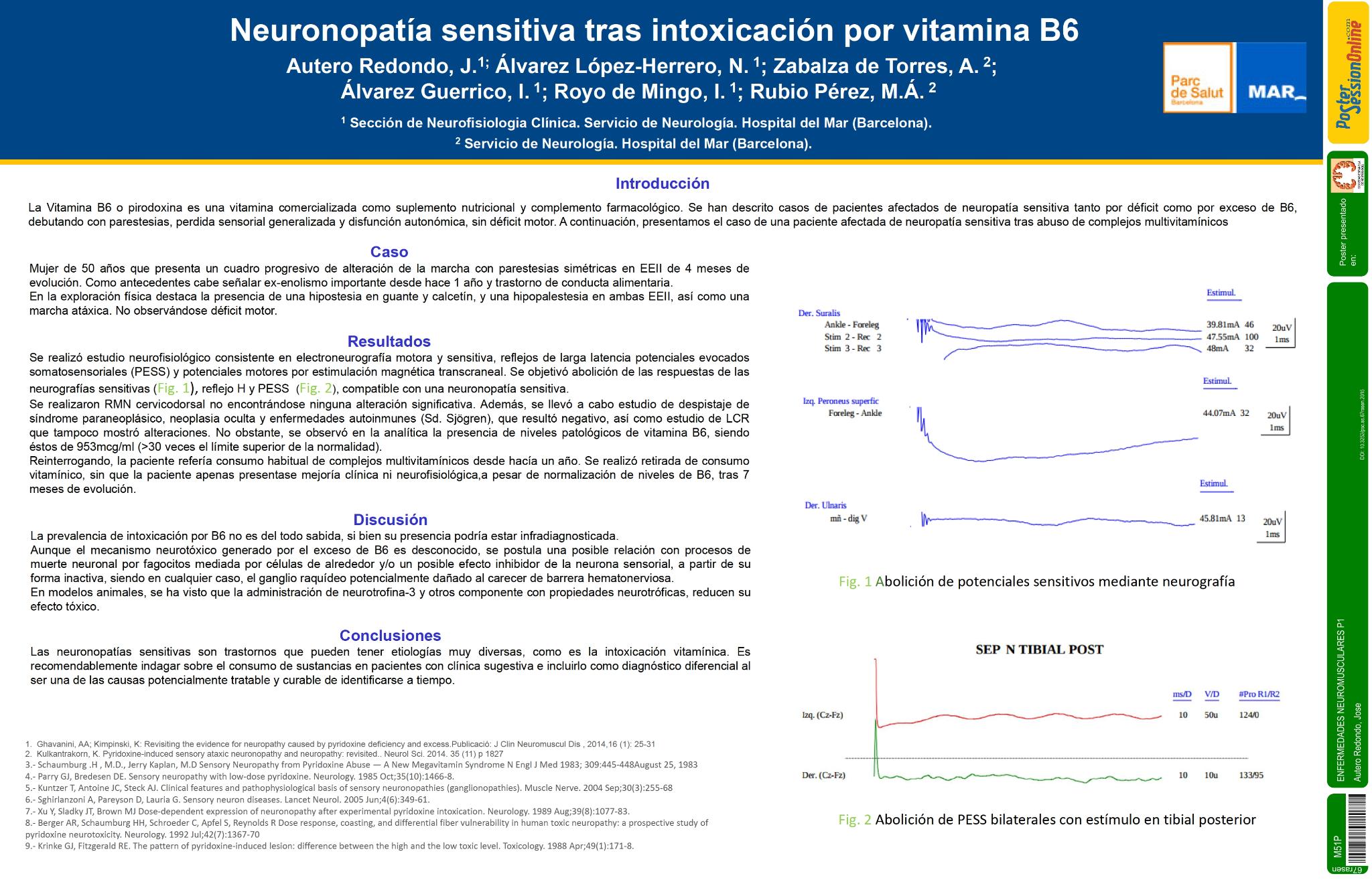 Neuronopatía sensitiva tras intoxicación por vitamina B6