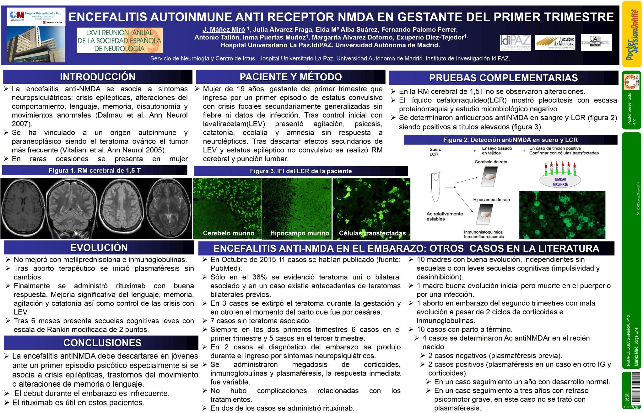 Encefalitis autoinmune anti receptor NMDA en gestante del primer timestre