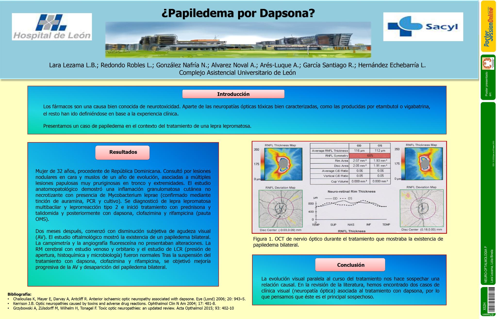 ¿Papiledema por Dapsona?