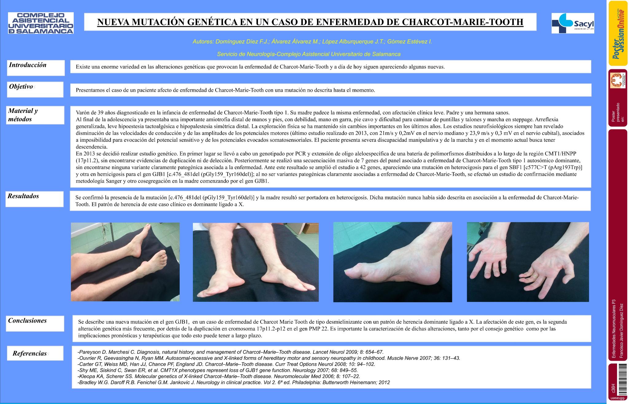 Nueva mutación genética en un caso de enfermedad de Charcot-Marie-Tooth