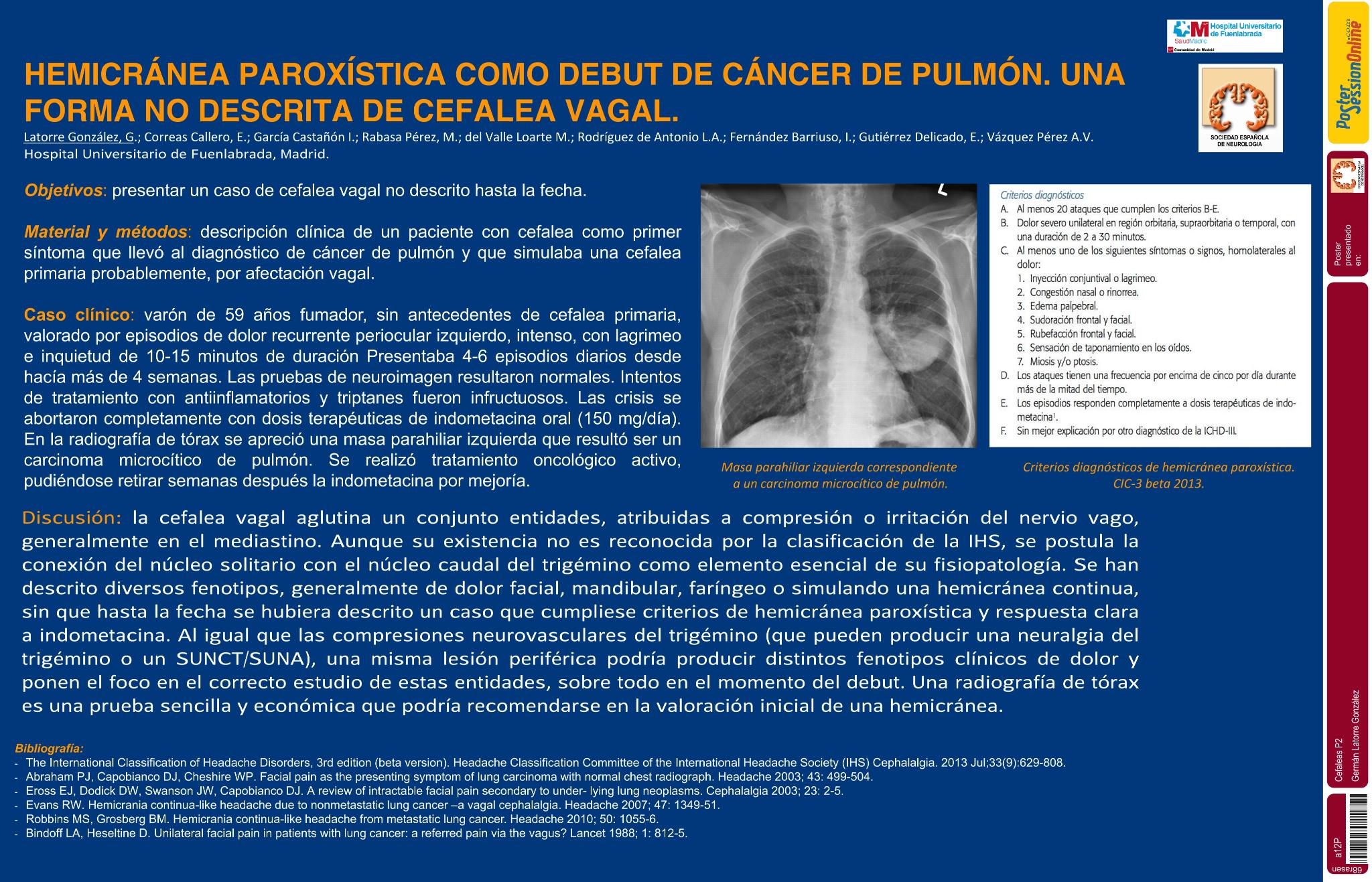 Hemicránea paroxística como debut de cáncer de pulmón. Una forma no descrita de cefalea vagal