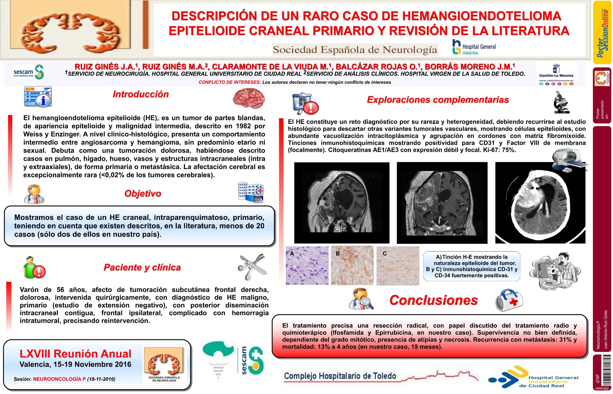 Descripción de un raro caso de hemangioendotelioma epitelioide craneal primario y revisión de la literatura