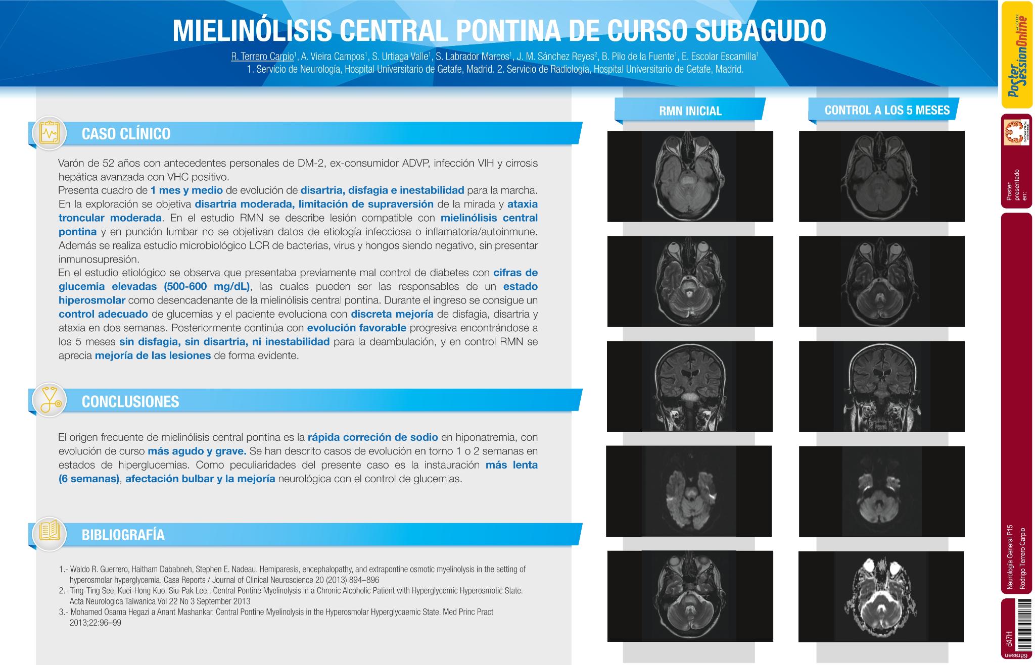 Mielinolisis central pontina de curso subagudo