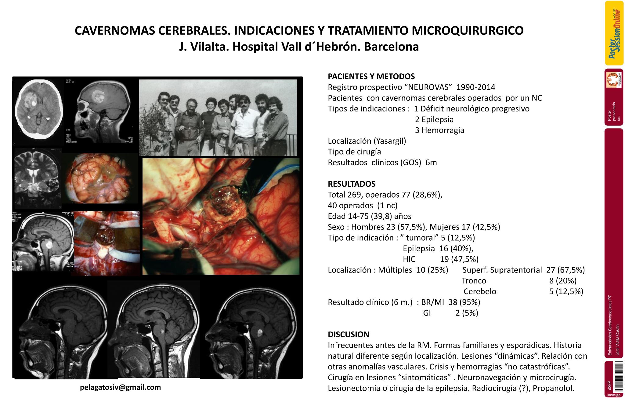 Cavernomas cerebrales. Indicaciones y tratamiento microquirúrgico