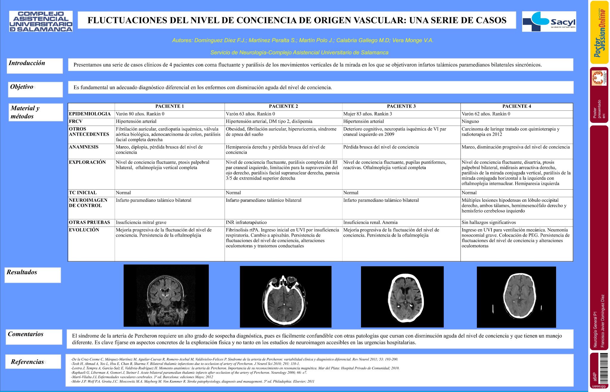 Fluctuaciones del nivel de conciencia de origen vascular. Una serie de casos
