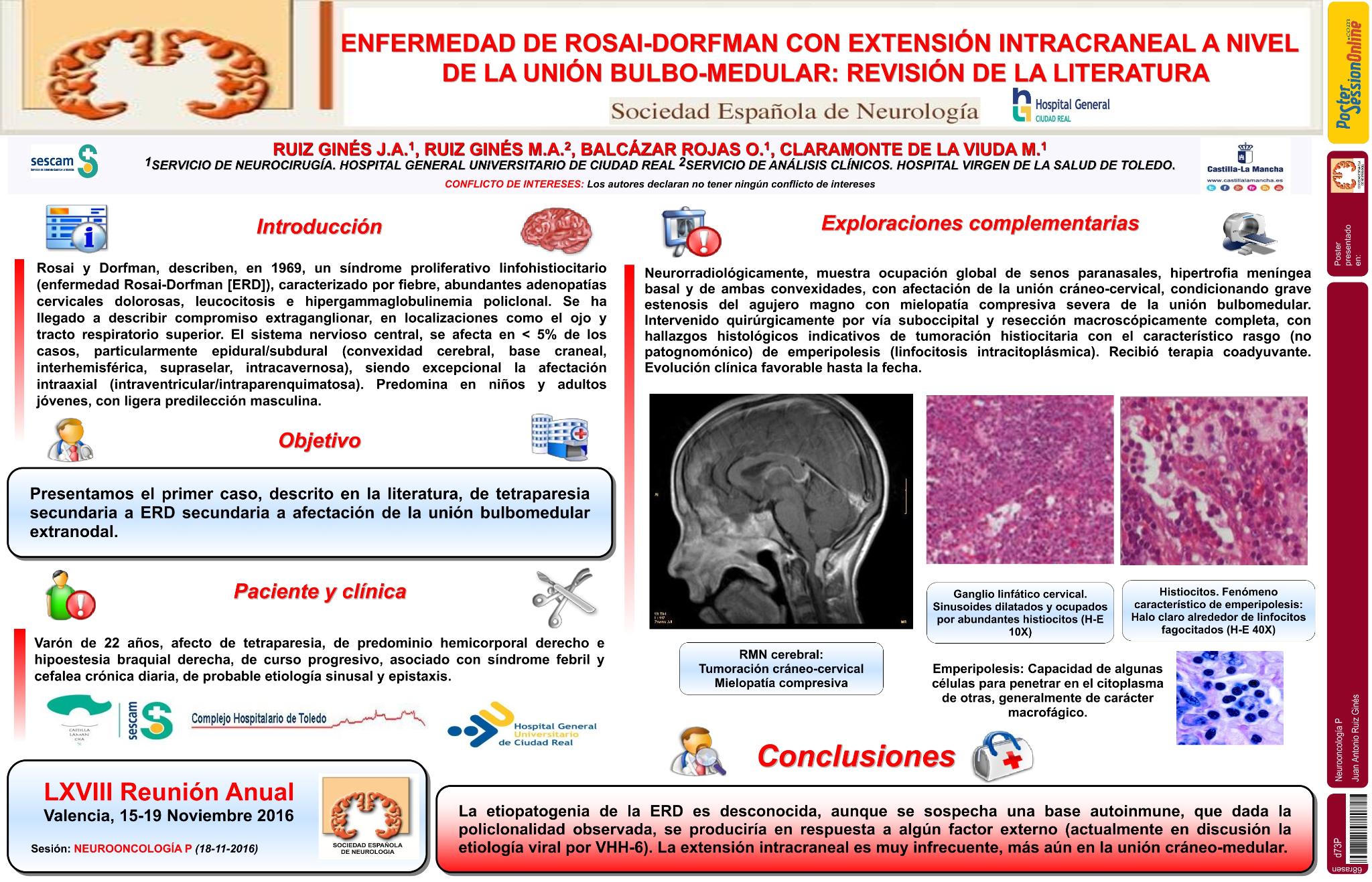 Enfermedad de Rosai-Dorfman con extensión intracraneal a nivel de la unión bulbo-medular: revisión de la literatura