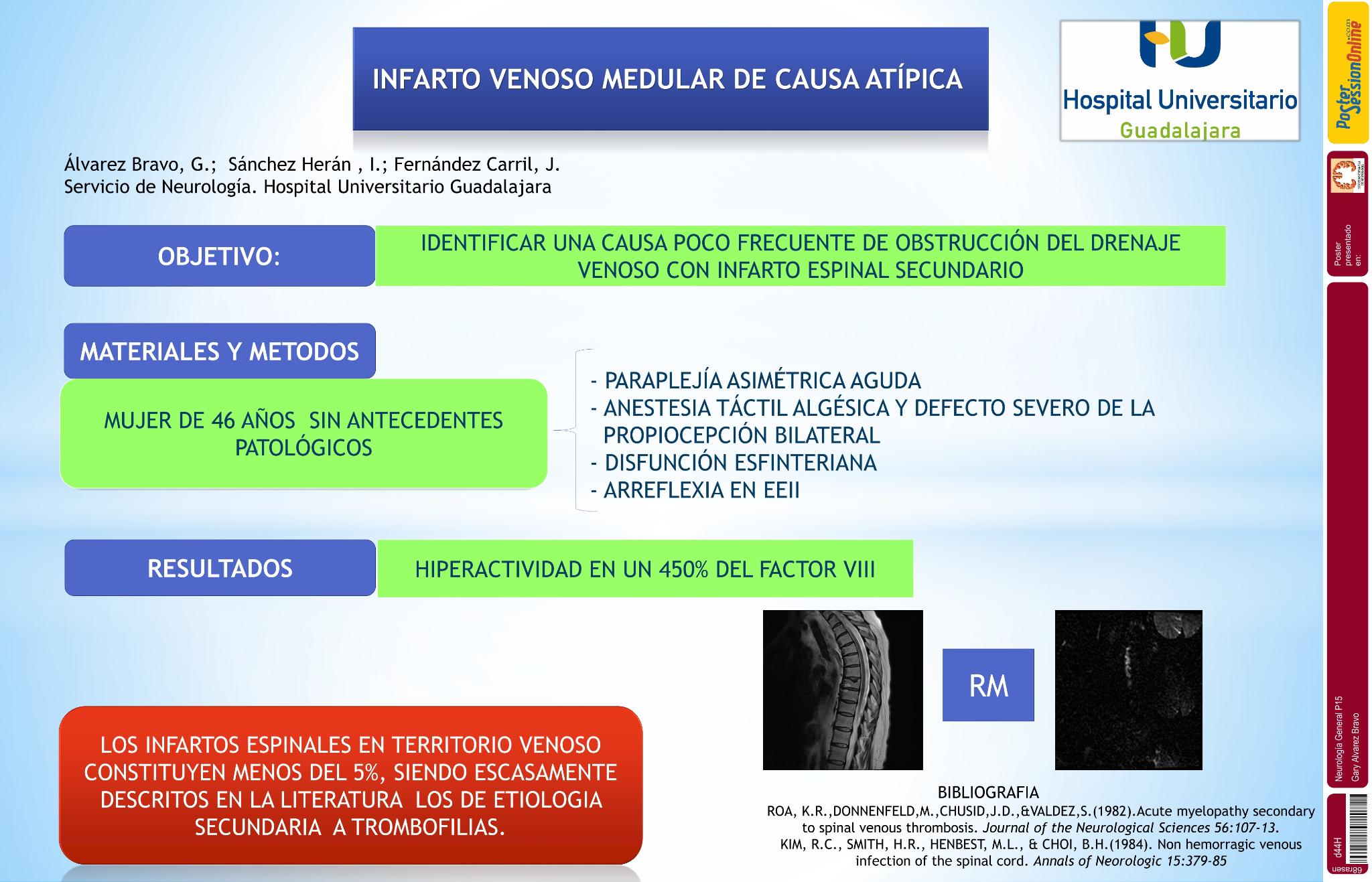Infarto venoso medular de causa “atípica”