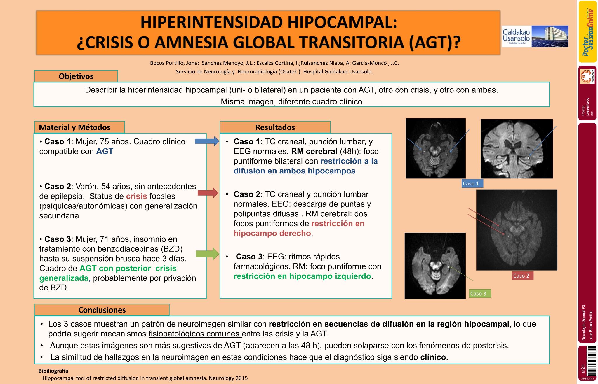 Hiperintensidad  hipocampal: ¿Crisis o amnesia global transitoria (AGT)?