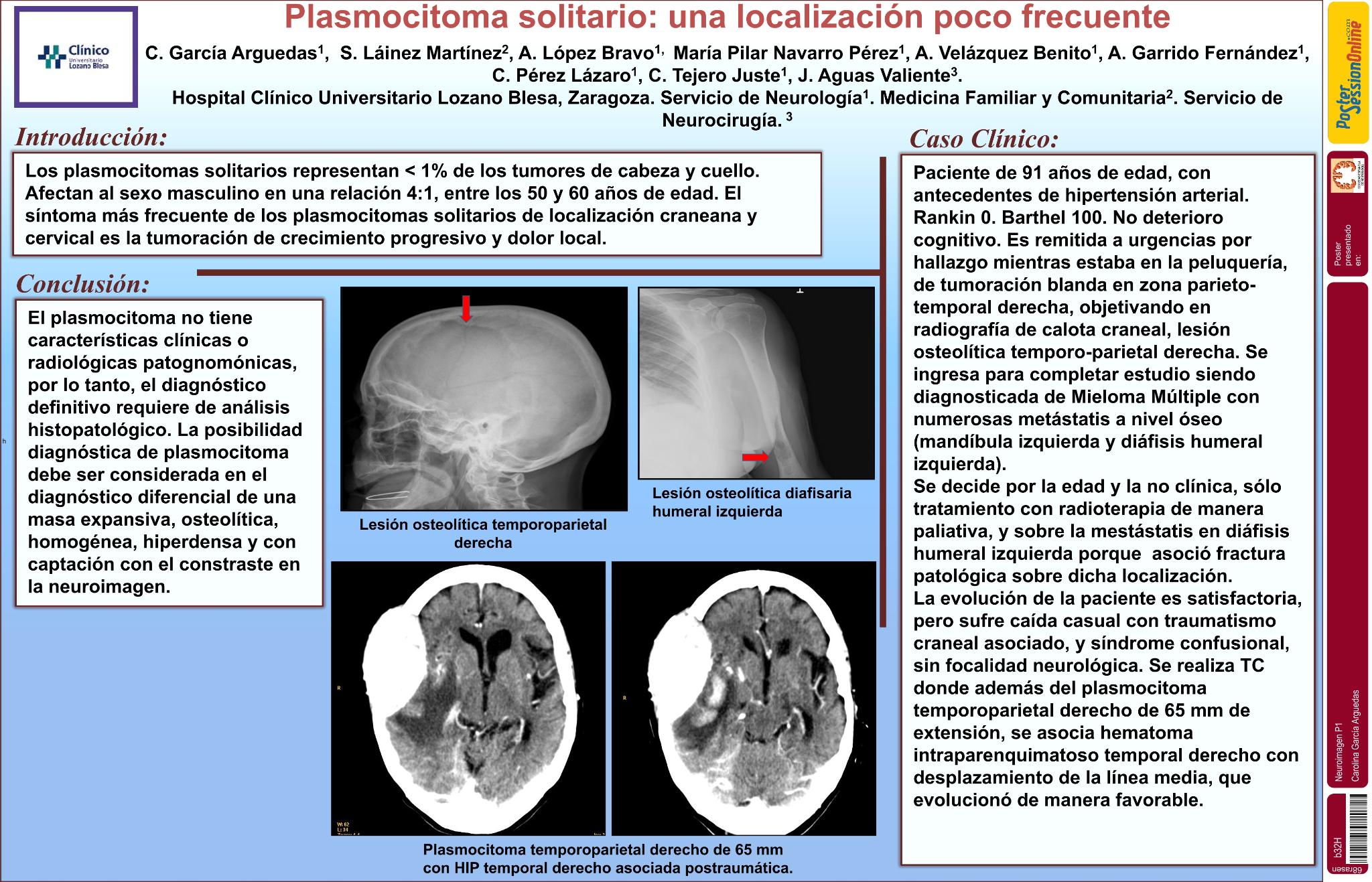 Plasmocitoma solitario: una localización poco frecuente