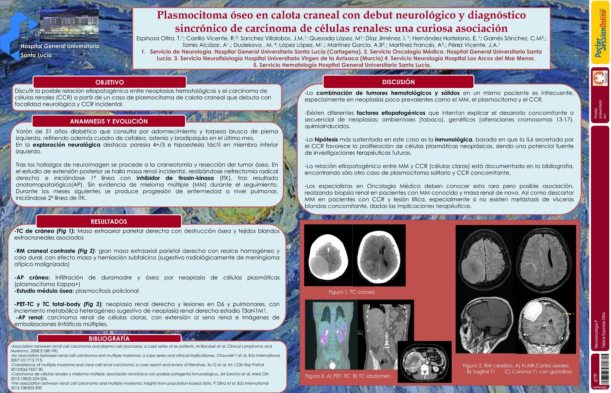 Plasmocitoma óseo en calota craneal con debut neurológico y diagnóstico sincrónico de carcinoma de células renales: Una curiosa asociación