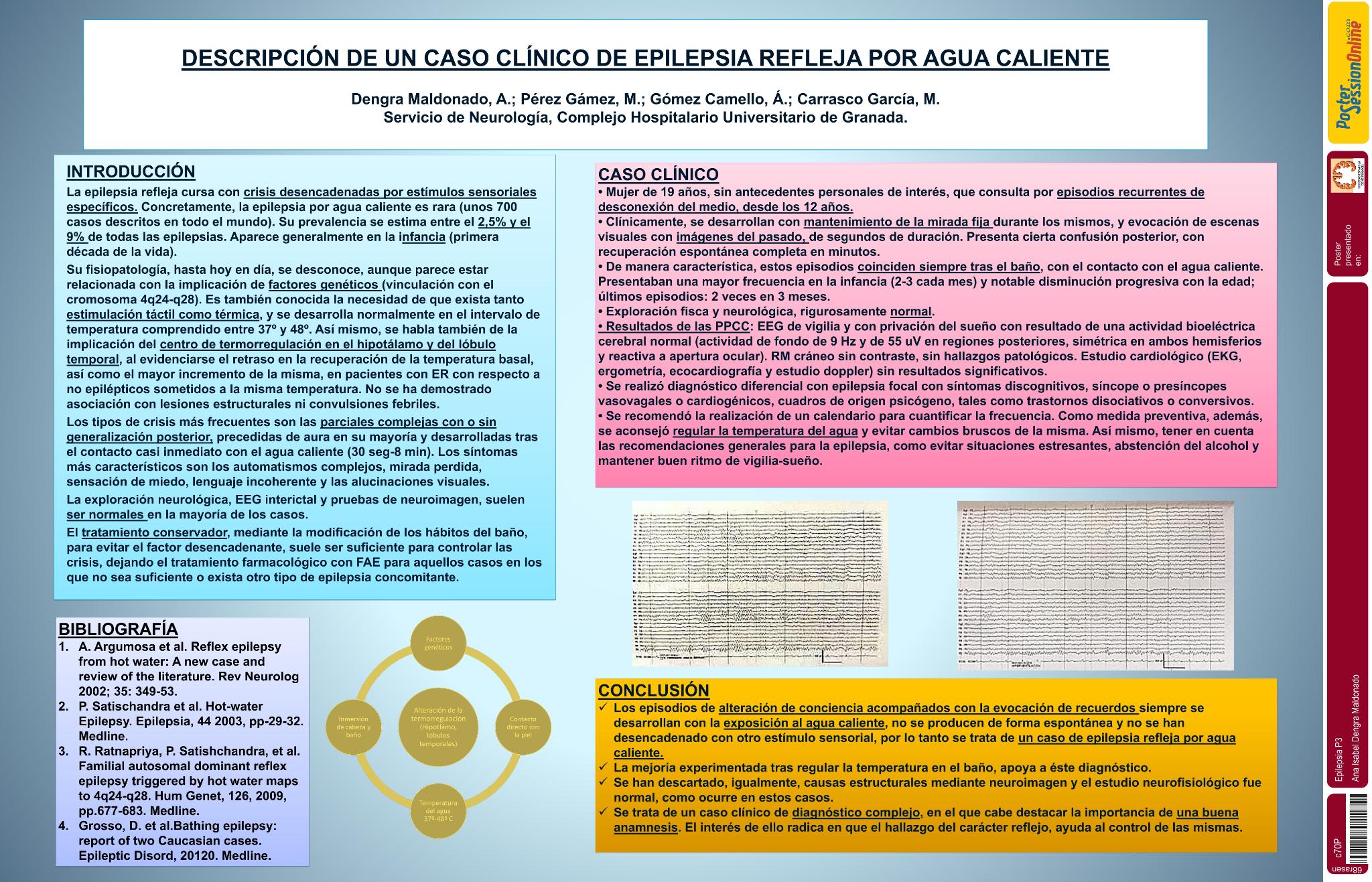 Descripción de un caso clínico de epilepsia refleja por agua caliente: Un tipo de epilepsia excepcional