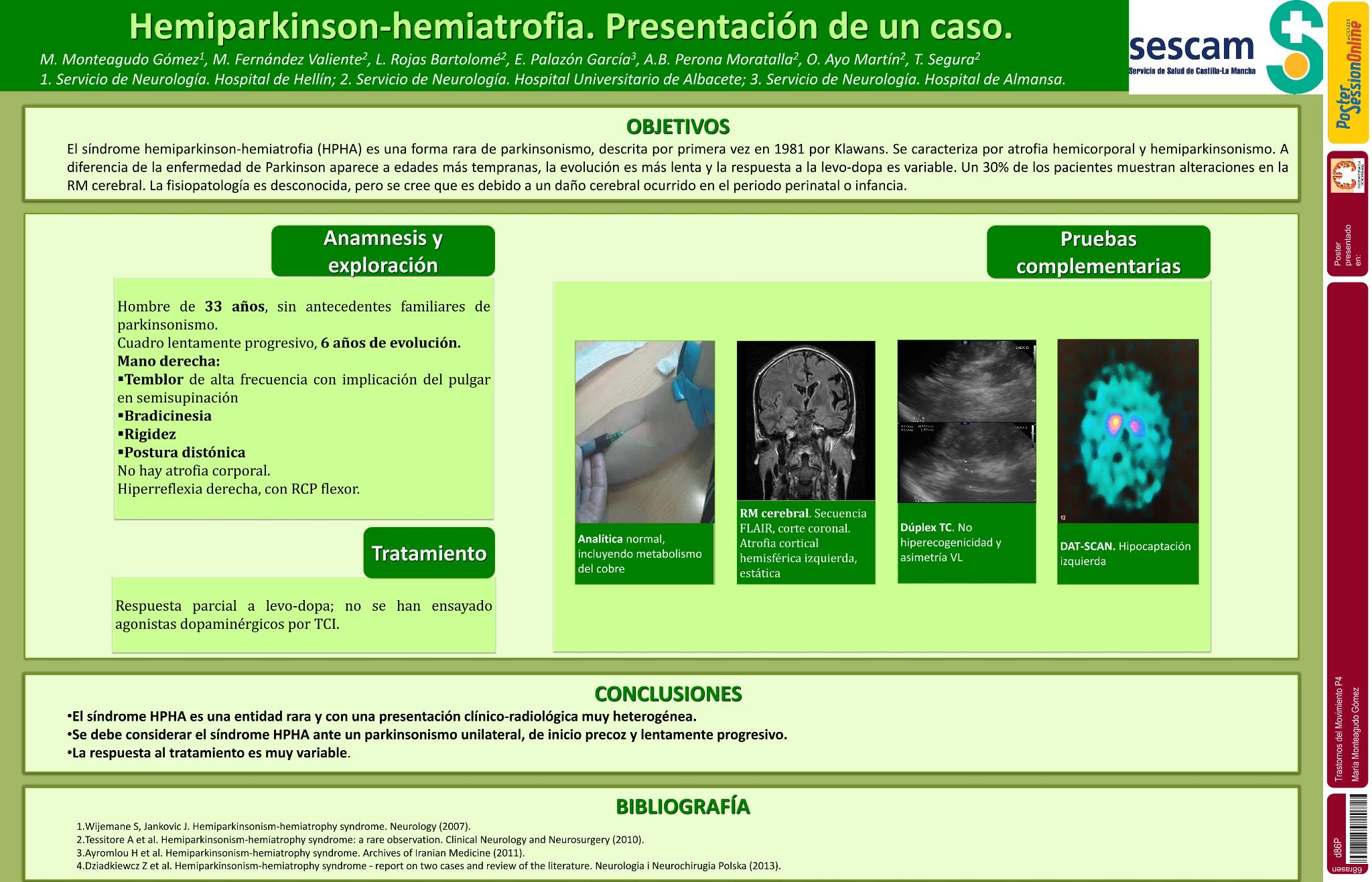 Hemiparkinson-hemiatrofia. Presentación de un caso