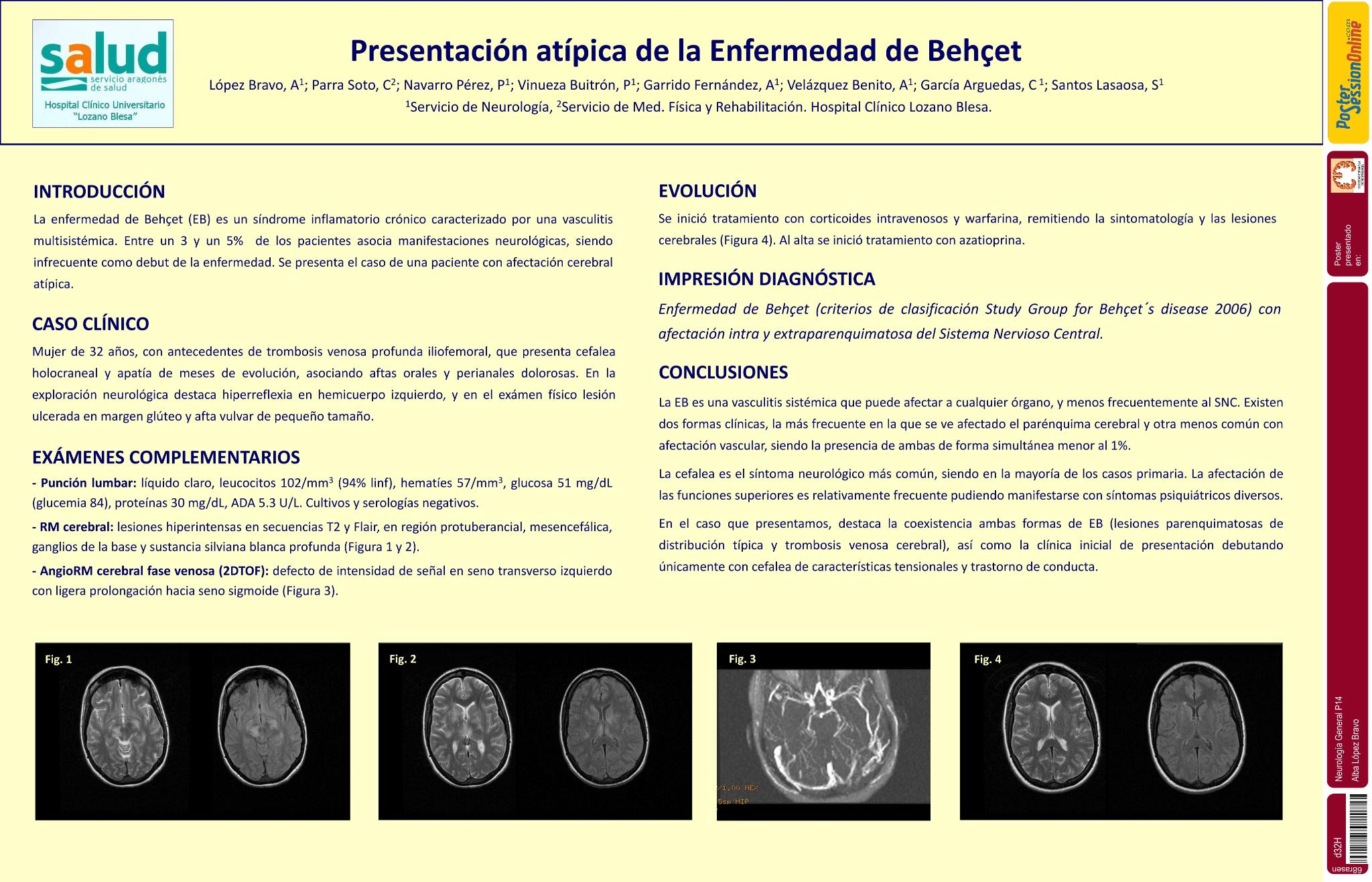 Presentación atípica de la Enfermedad de Behçet