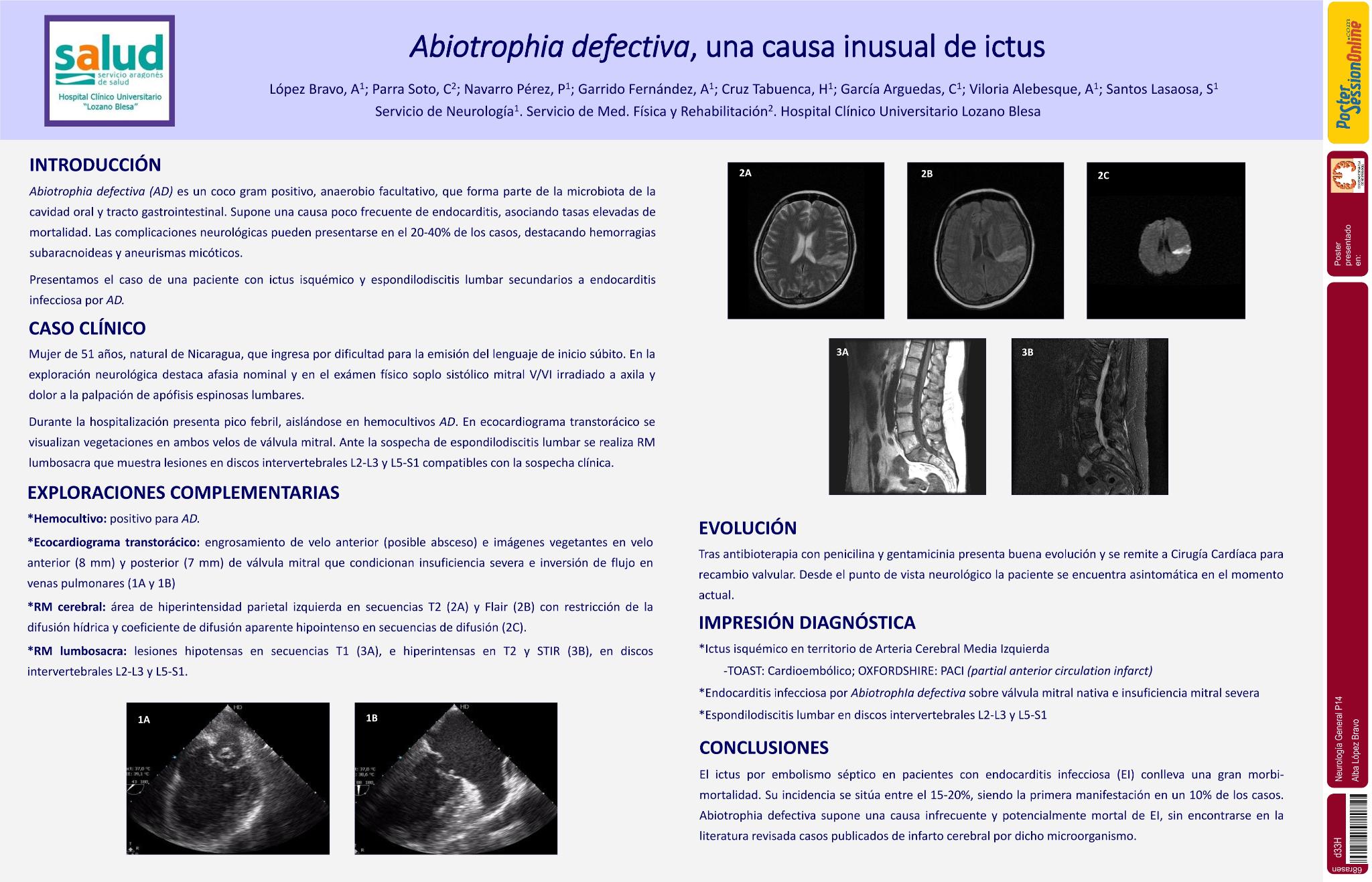 Abiotrofia defectiva, una causa inusual de ictus