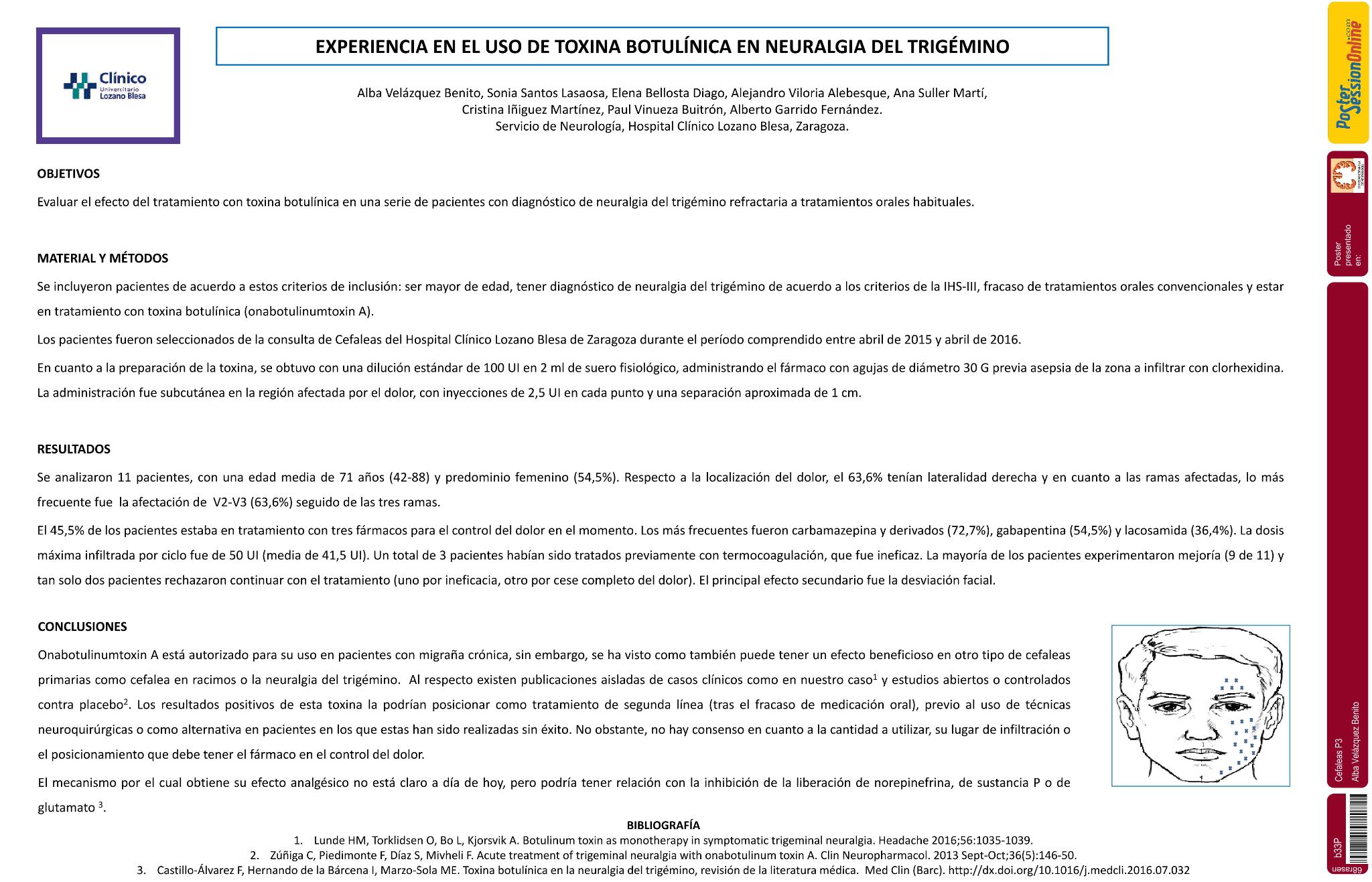 Experiencia en el uso de toxina botulínica en neuralgia del trigémino