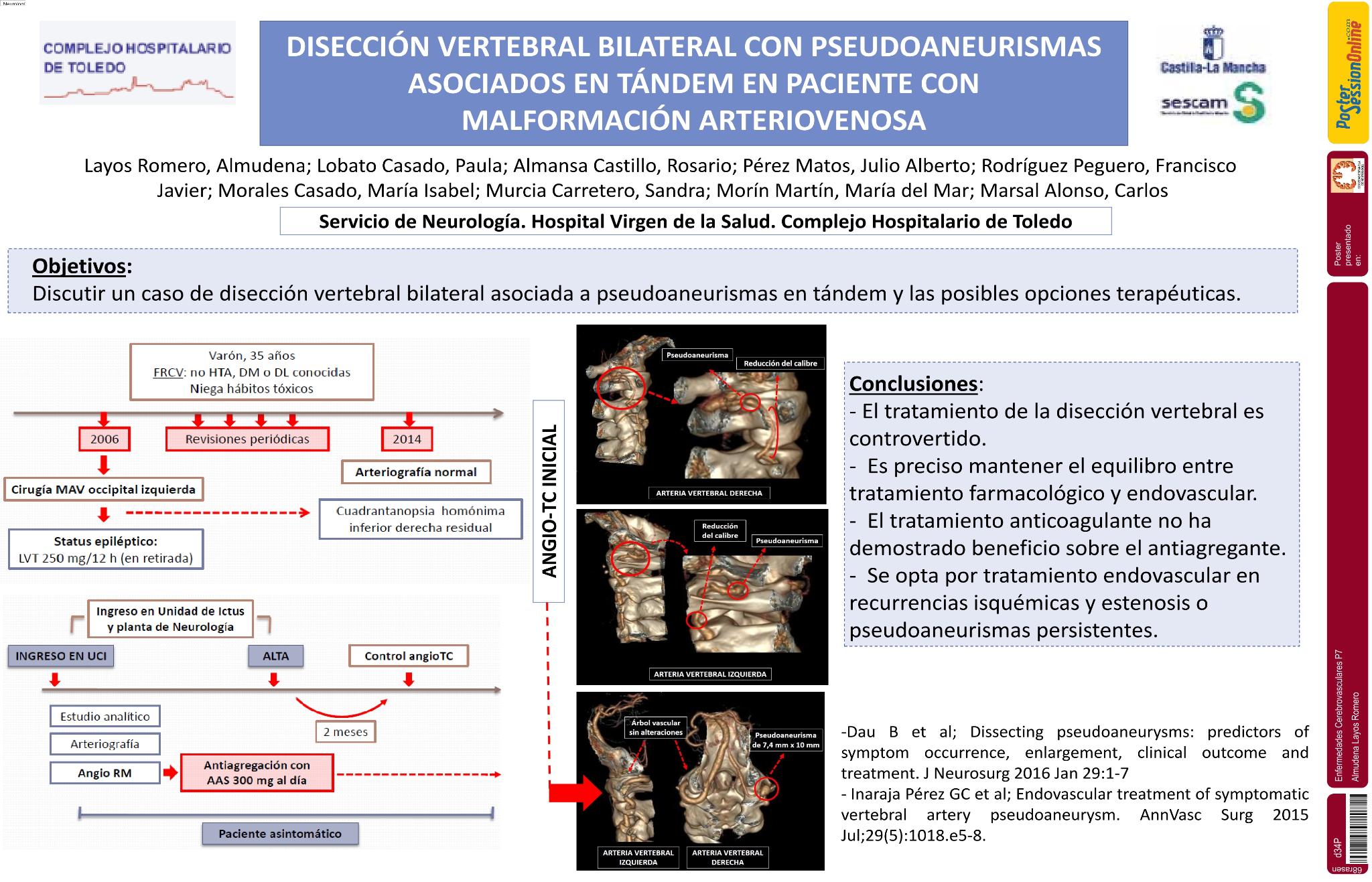 Disección vertebral bilateral con pseudoaneurismas asociados en tándem, en paciente con malformación arteriovenosa