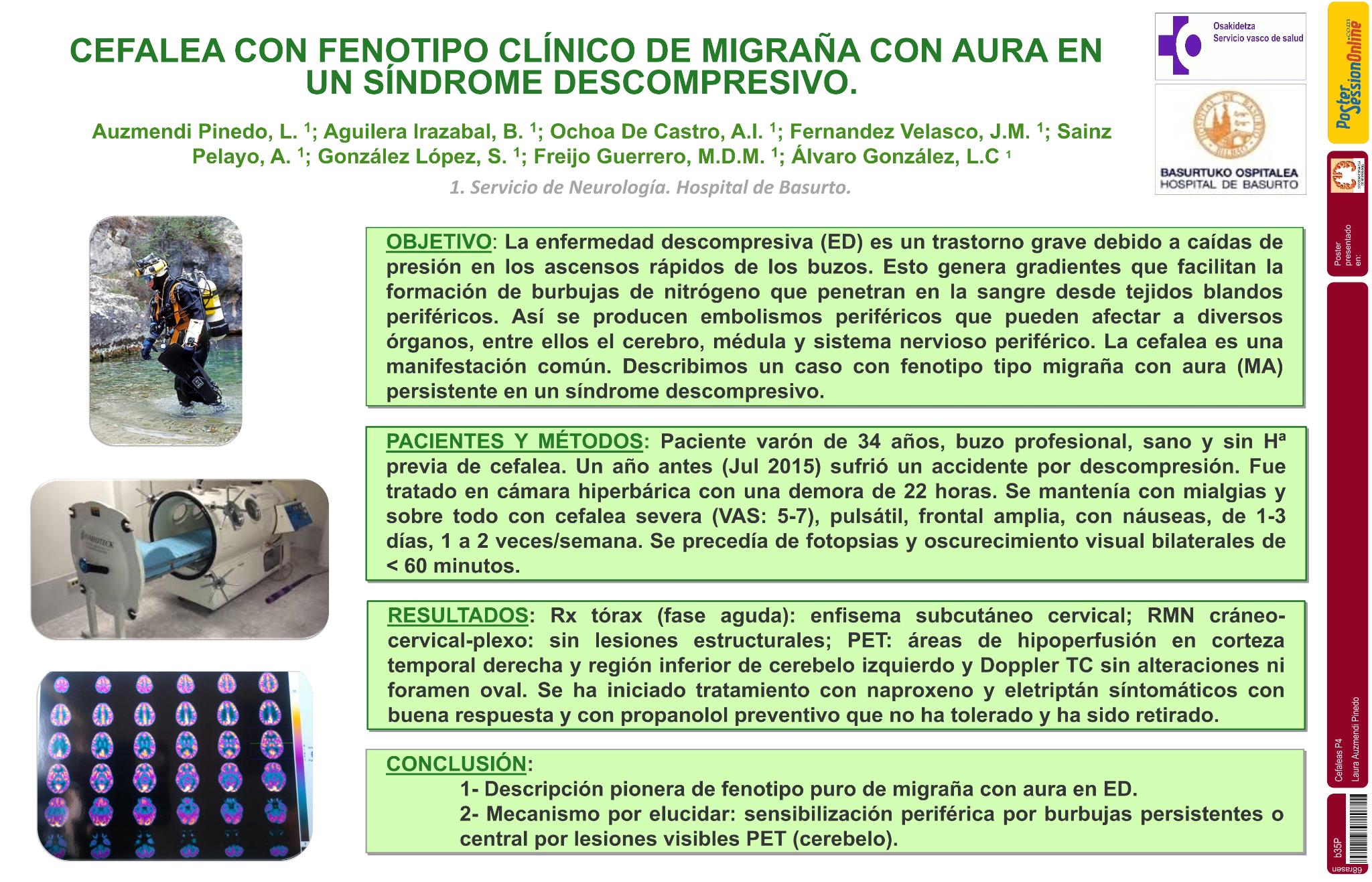 Cefalea con fenotipo clínico de migraña con aura en un síndrome descompresivo