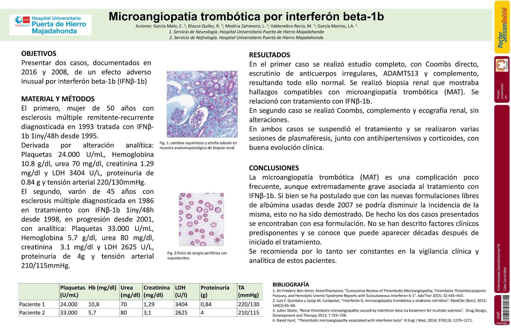Microangiopatía trombótica por interferón beta-1b