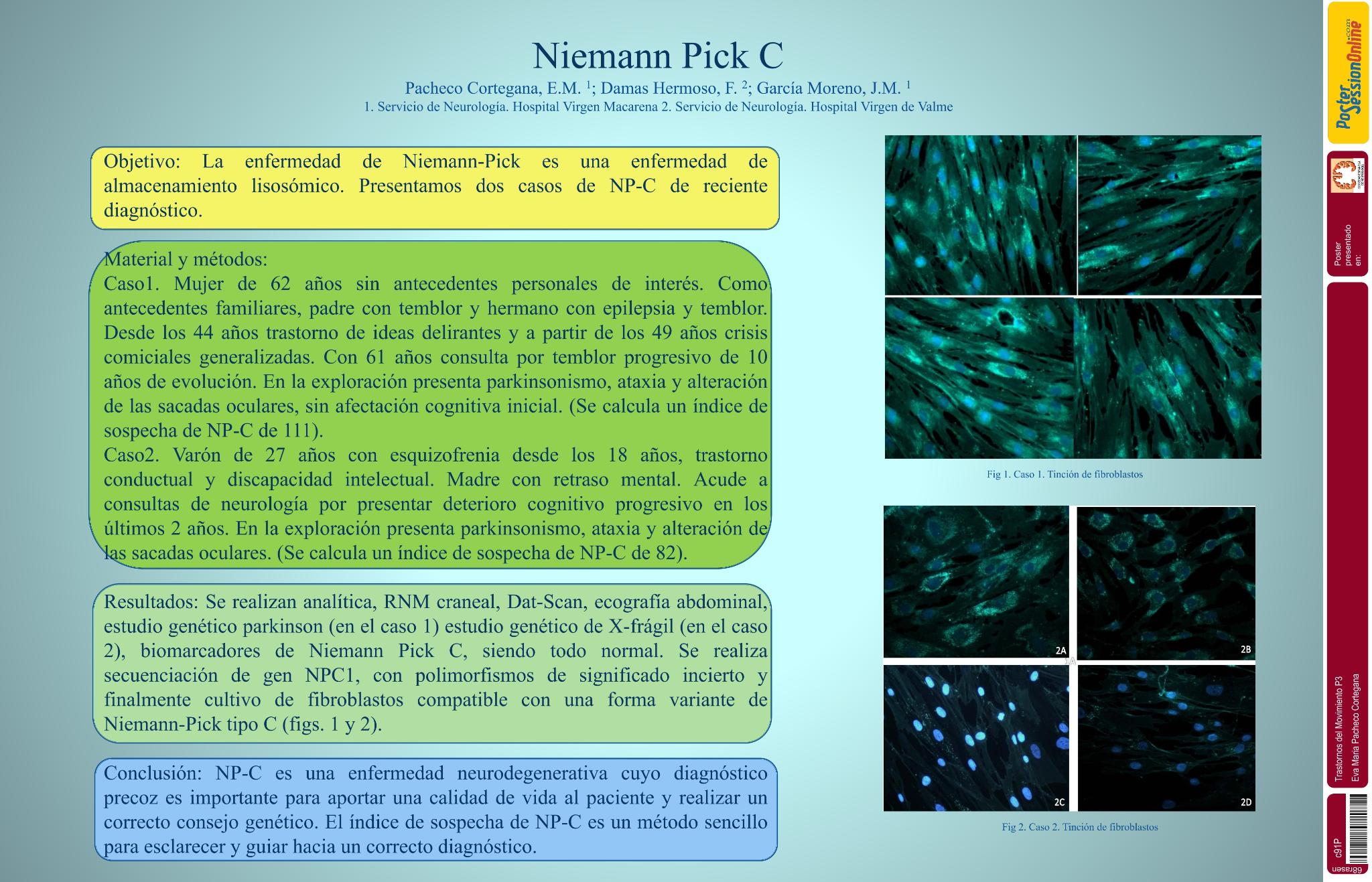 Niemann Pick C
