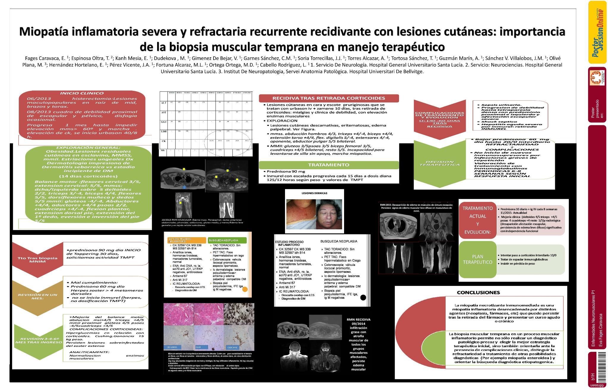 Miopatia inflamatoria severa y refractaria recurrente recidivante con lesiones cútaneas: importancia de la biopsia muscular temprana en manejo terapéutico