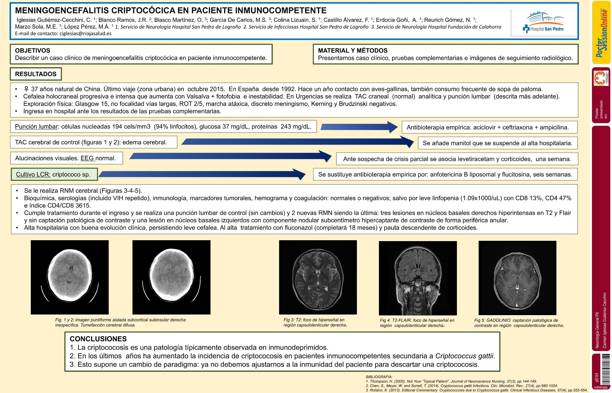 Meningoencefalitis criptocócica en paciente inmunocompetente